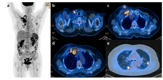 Diagnostics 12 02479 g002