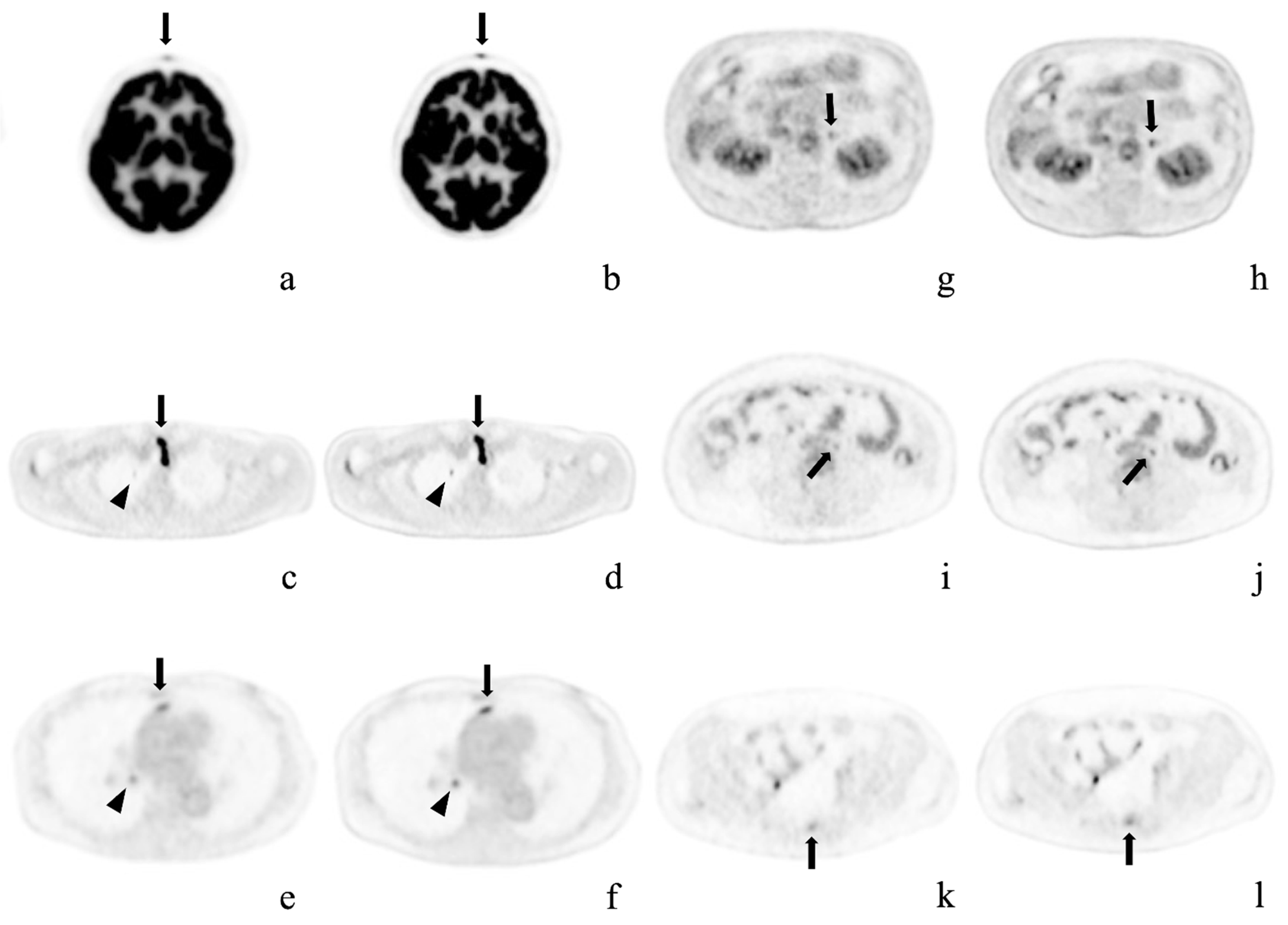 Diagnostics 12 02500 g003 Diagnostics 12 02500 g003