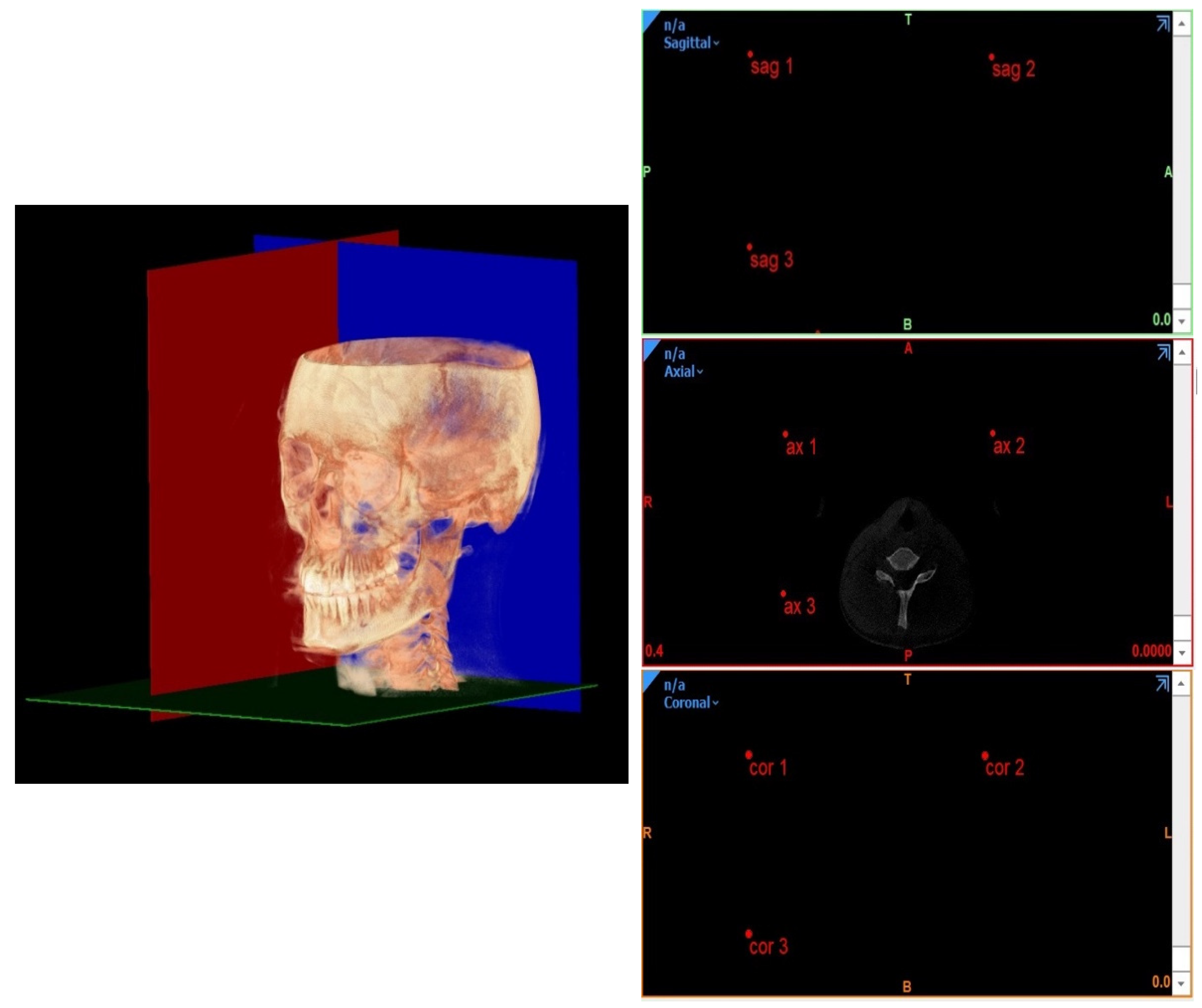 Diagnostics 12 02513 g004 Diagnostics 12 02513 g004