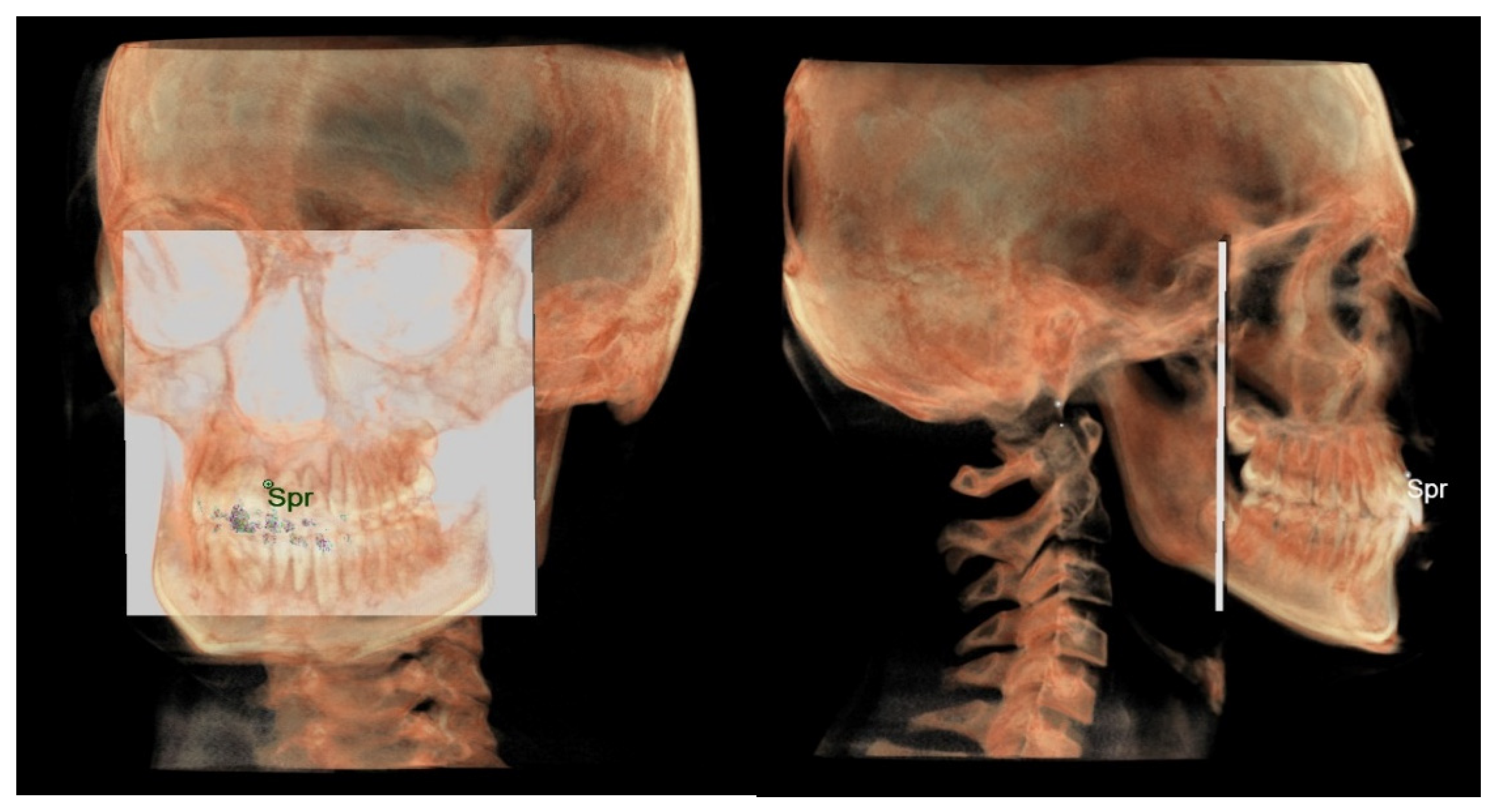 Diagnostics 12 02513 g008 Diagnostics 12 02513 g008