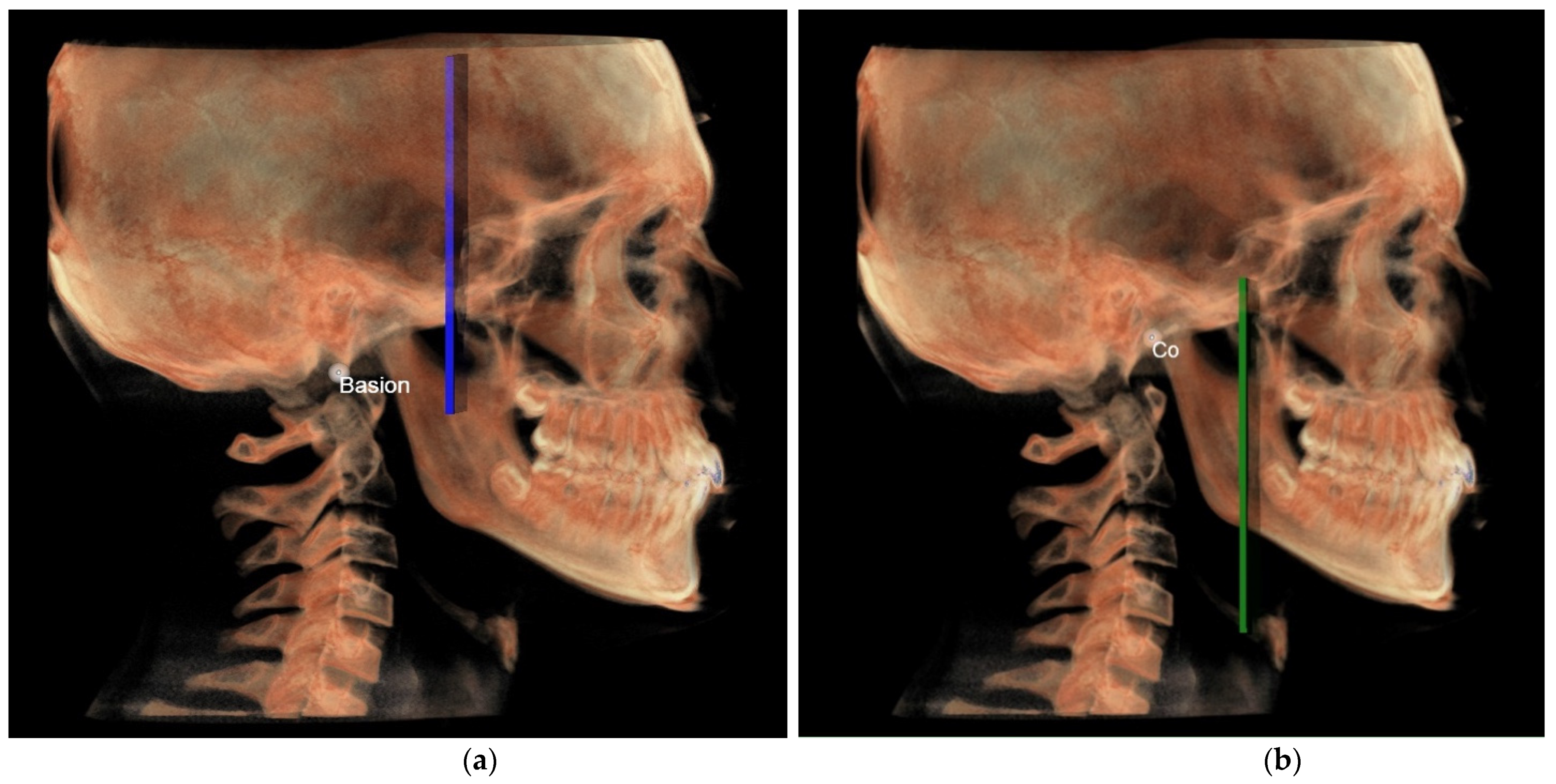 Diagnostics 12 02513 g010 Diagnostics 12 02513 g010