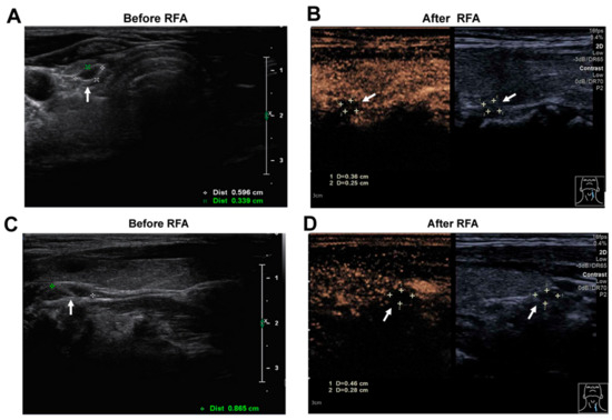 Diagnostics 12 02553 g003