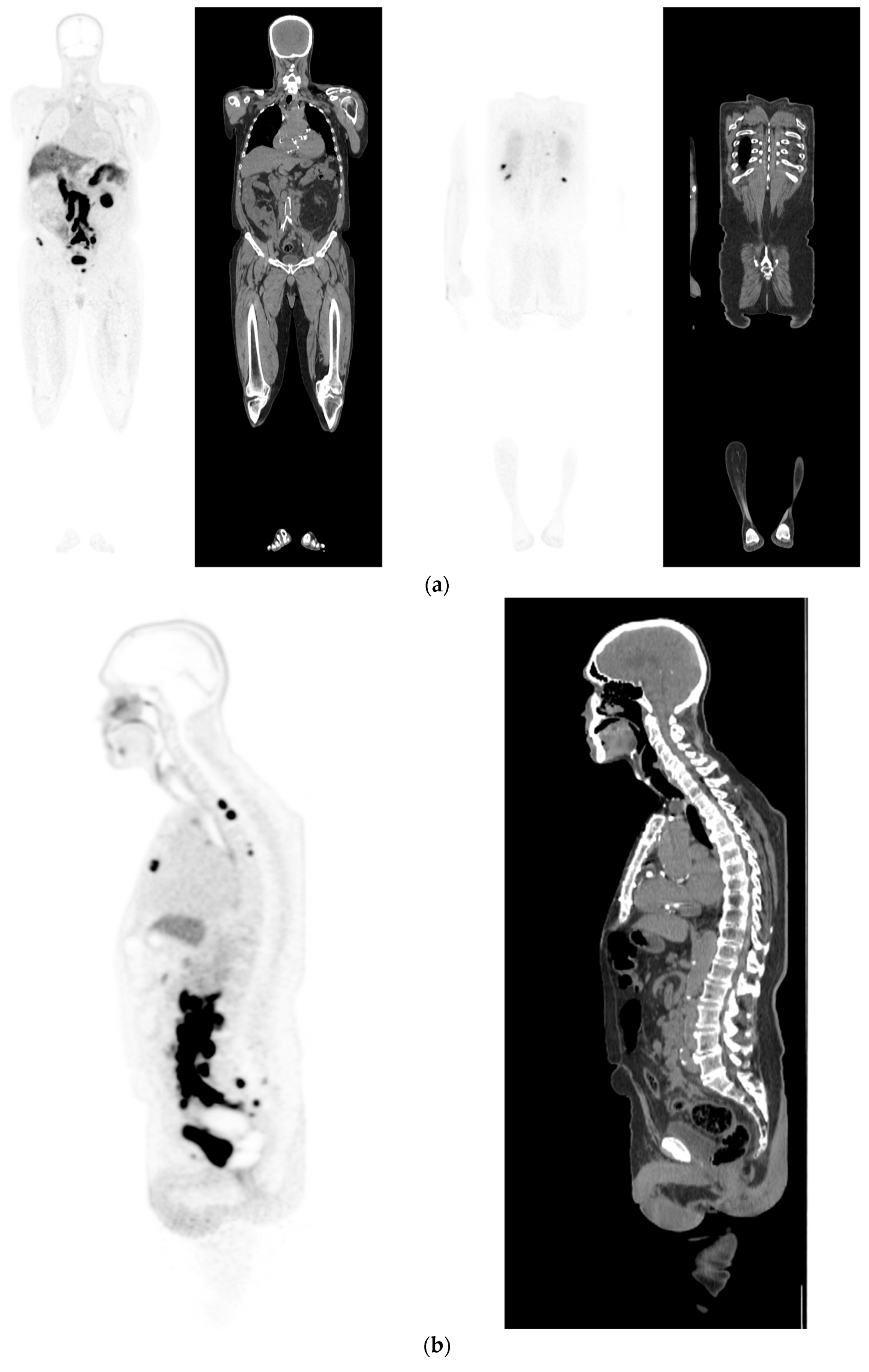Diagnostics 12 02594 g003a Diagnostics 12 02594 g003a