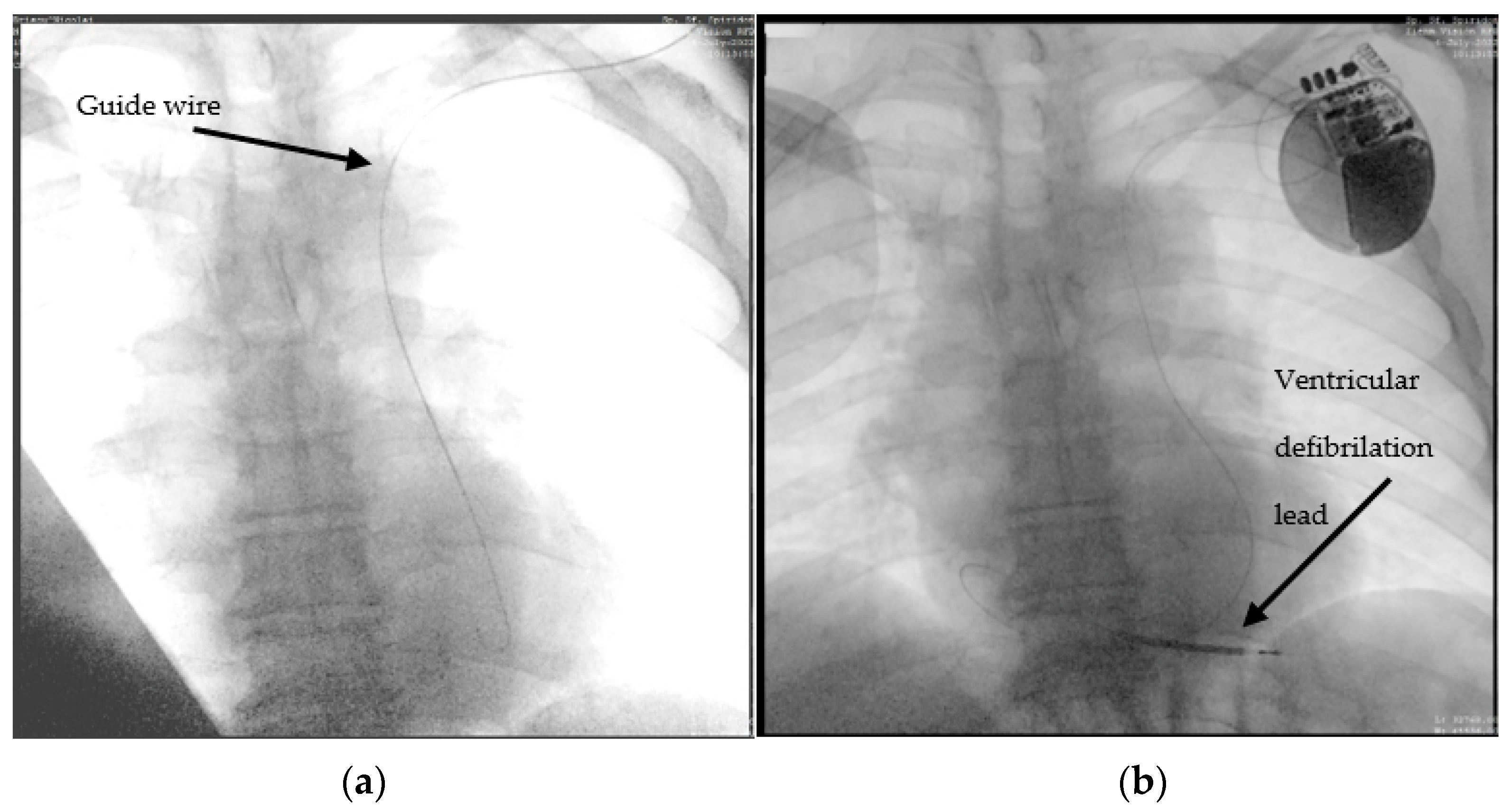 Diagnostics 12 02596 g002 Diagnostics 12 02596 g002
