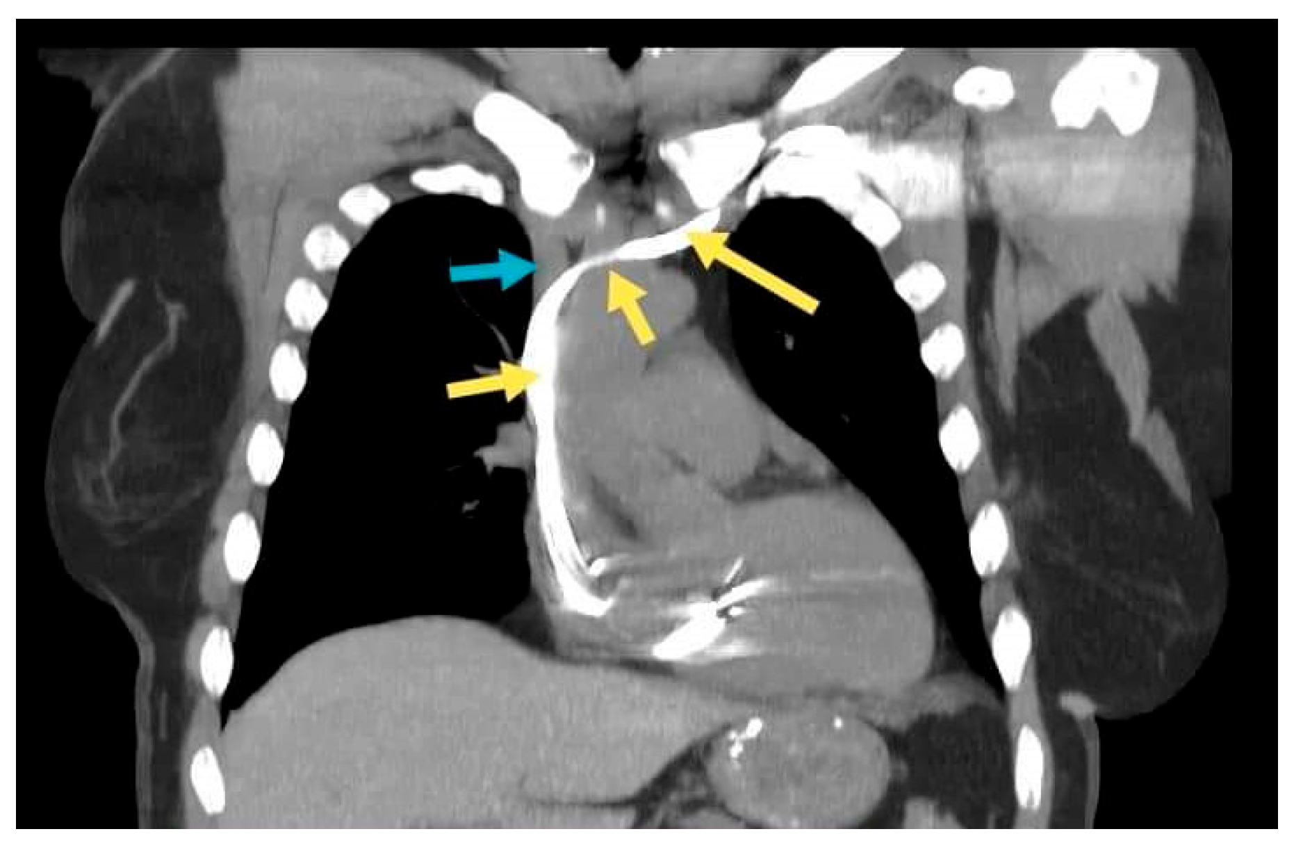 Diagnostics 12 02596 g004 Diagnostics 12 02596 g004