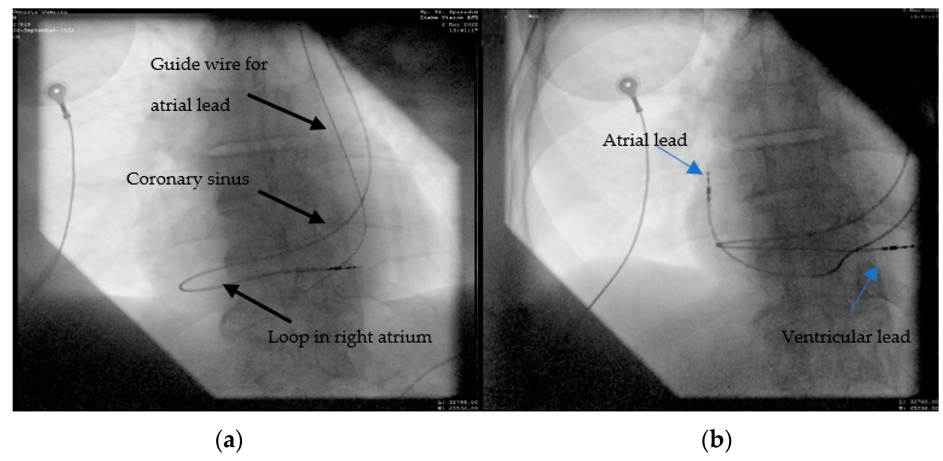 Diagnostics 12 02596 g005 Diagnostics 12 02596 g005