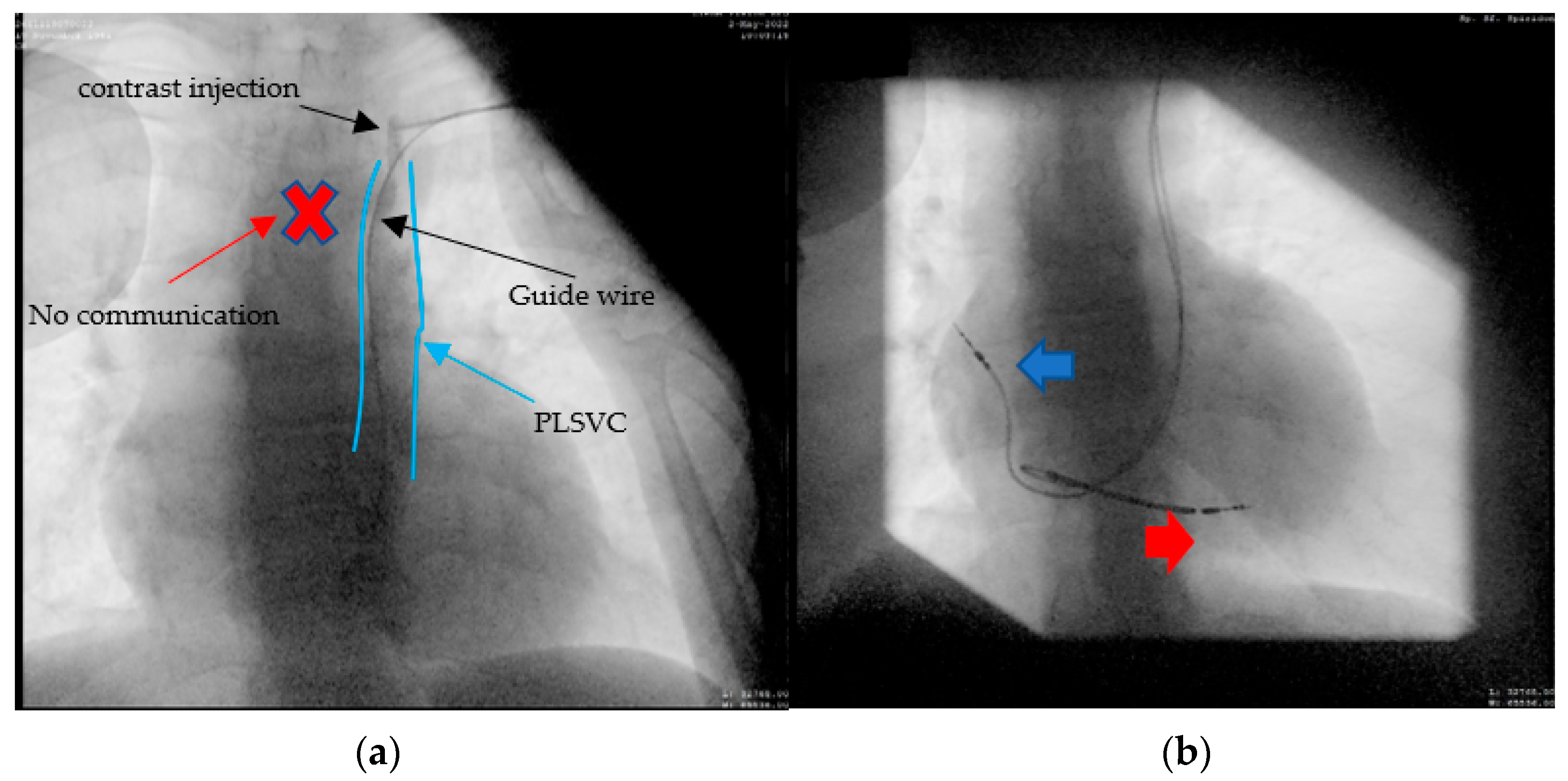 Diagnostics 12 02596 g006 Diagnostics 12 02596 g006