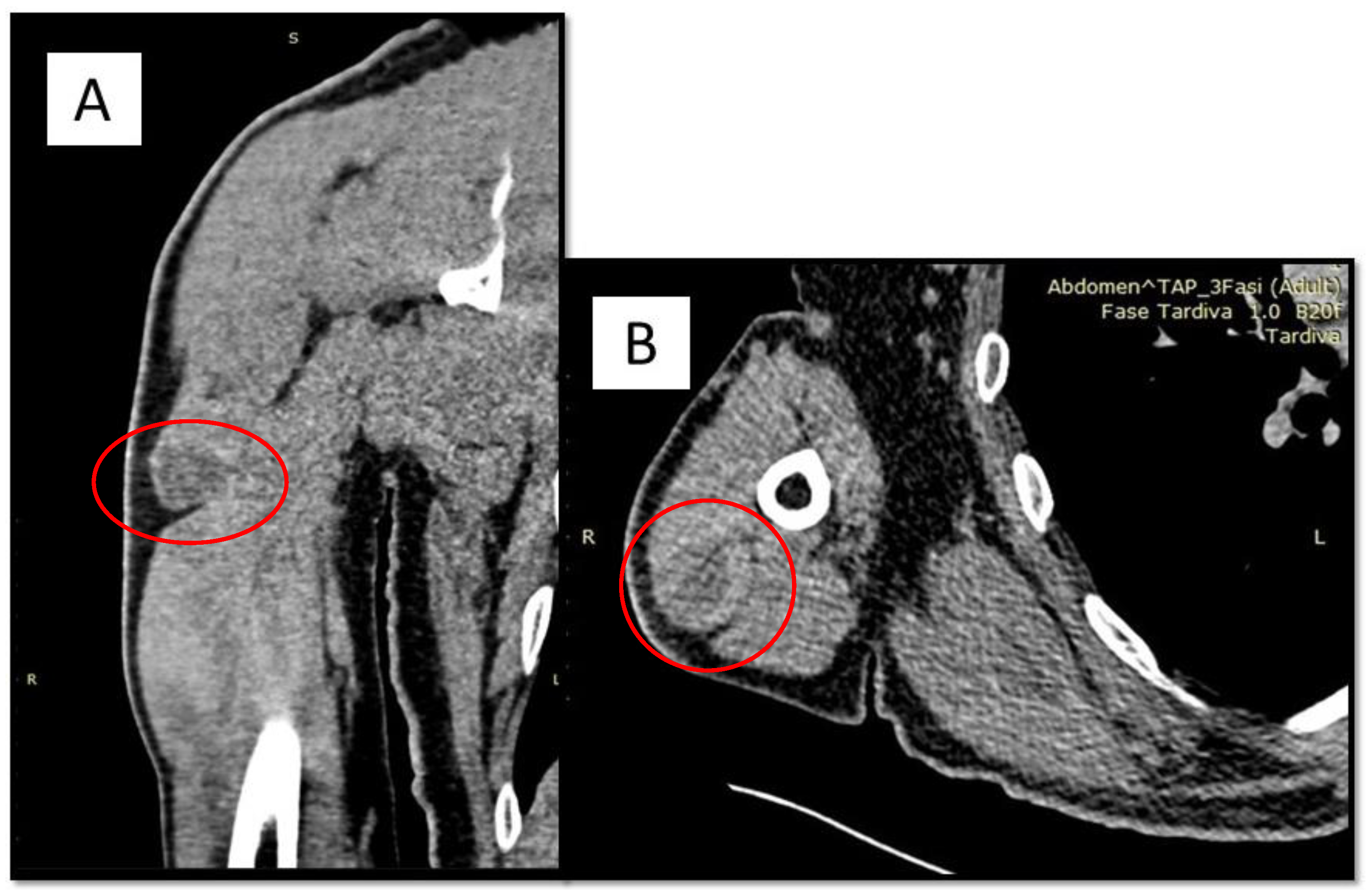 Diagnostics 12 02616 g001