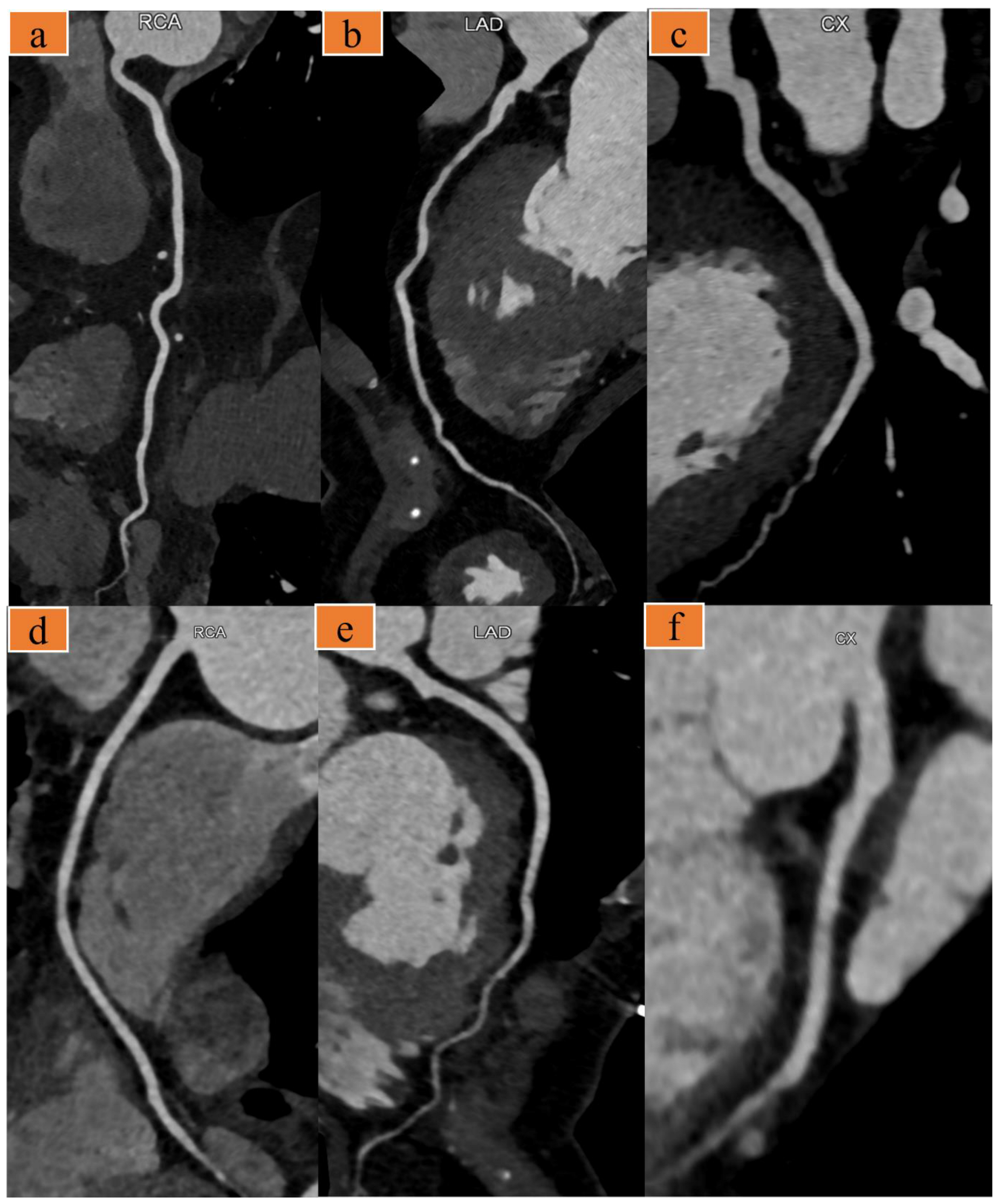 Diagnostics 12 02647 g002