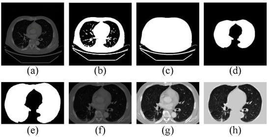 Diagnostics 12 02660 g004