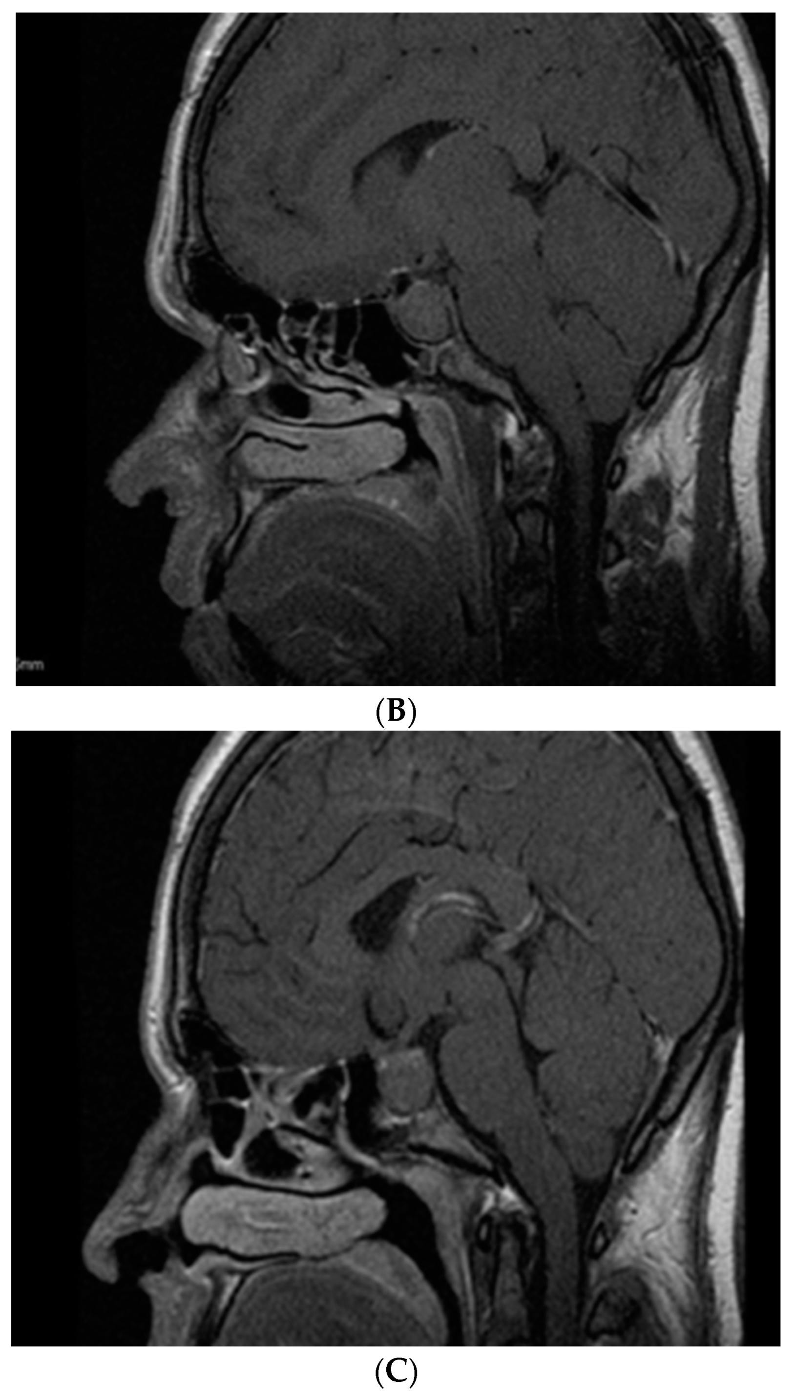 Diagnostics 12 02669 g003b