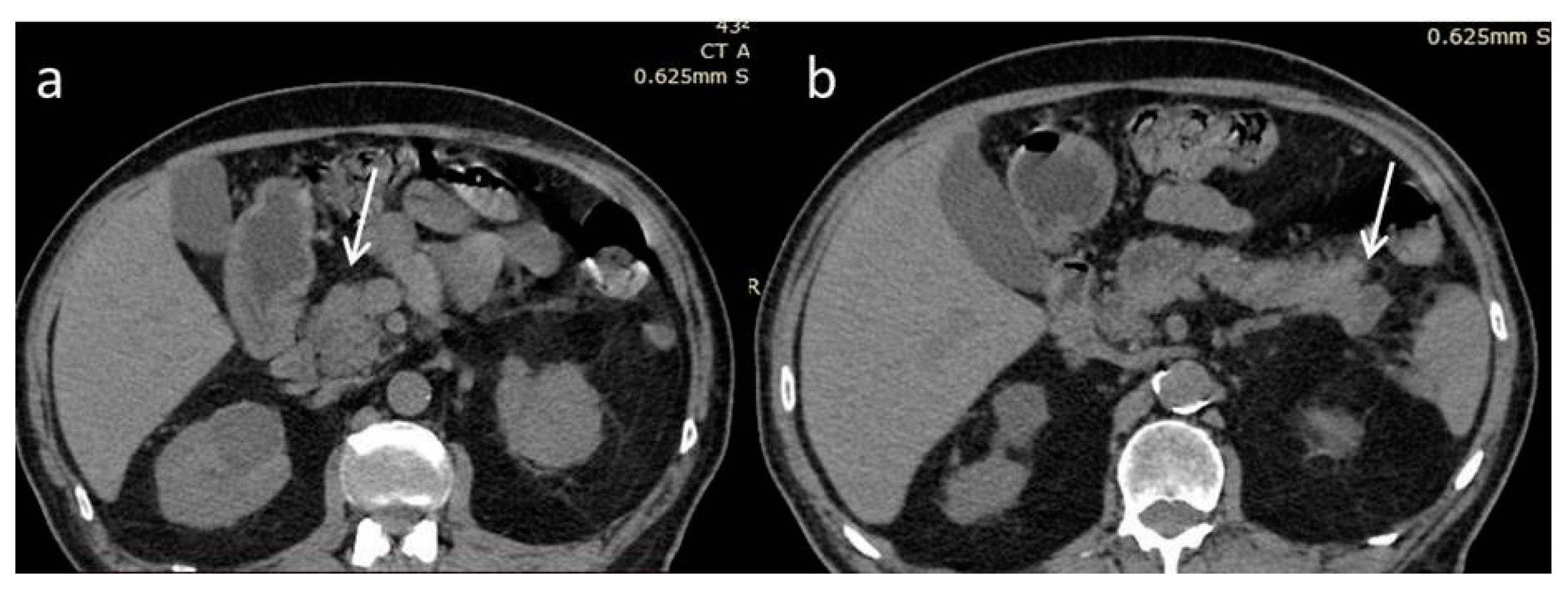 Diagnostics 12 02709 g001 Diagnostics 12 02709 g001