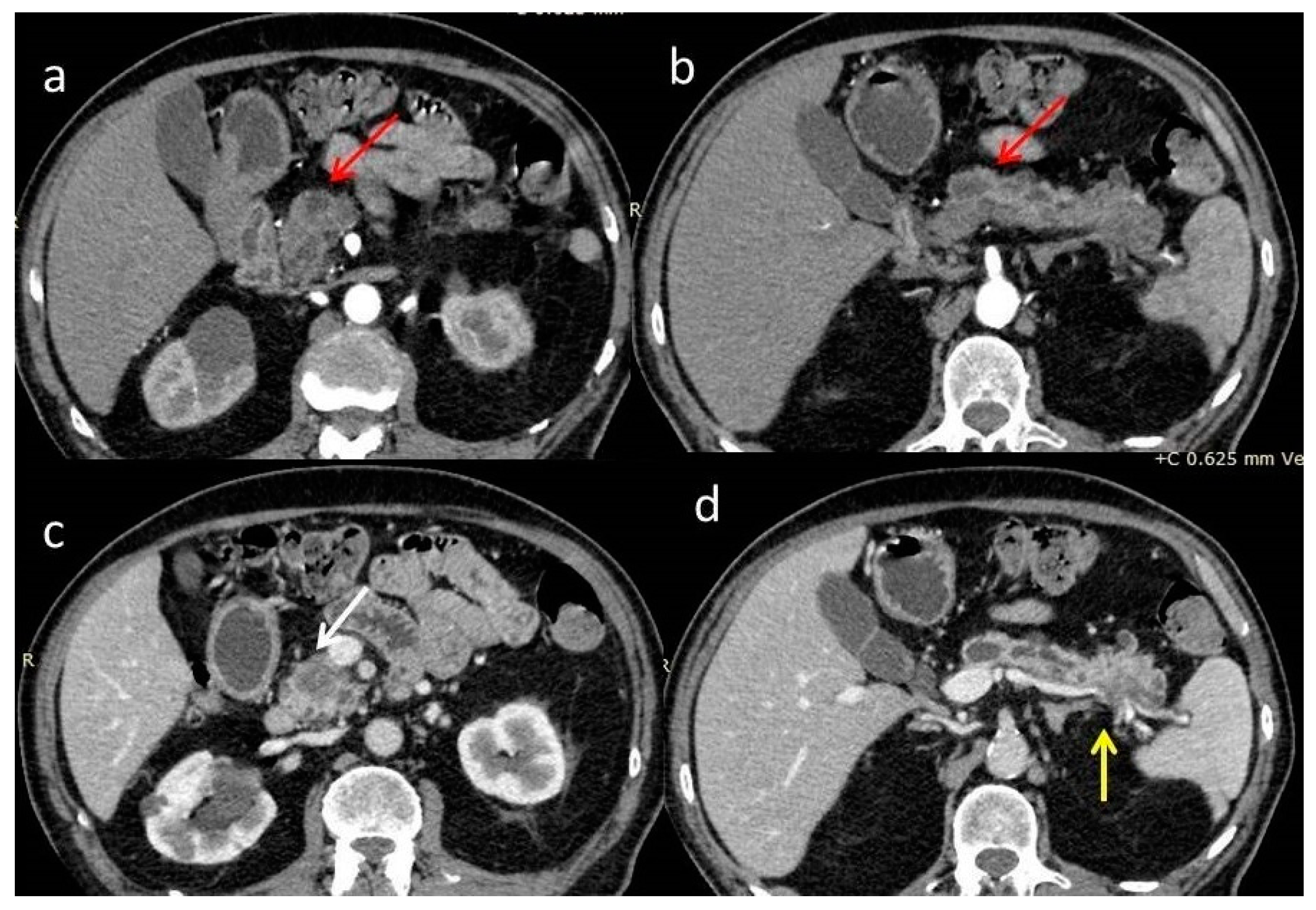 Diagnostics 12 02709 g002 Diagnostics 12 02709 g002