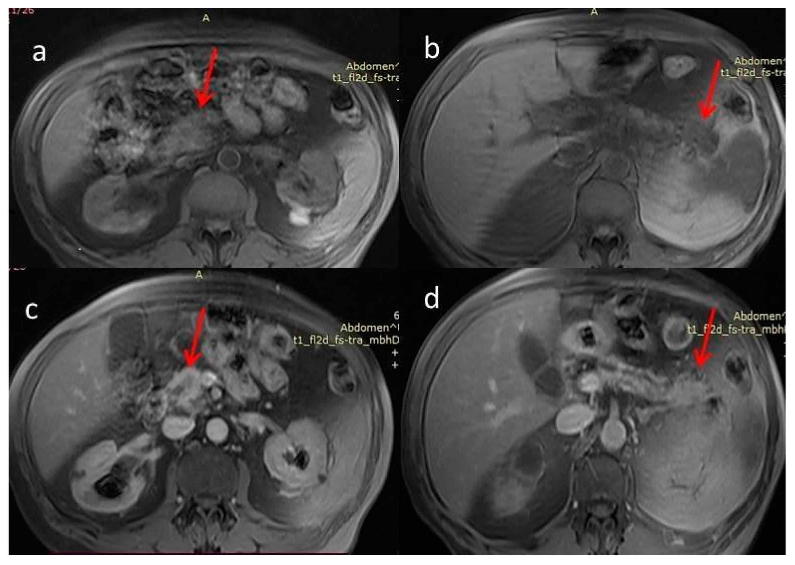 Diagnostics 12 02709 g004 Diagnostics 12 02709 g004