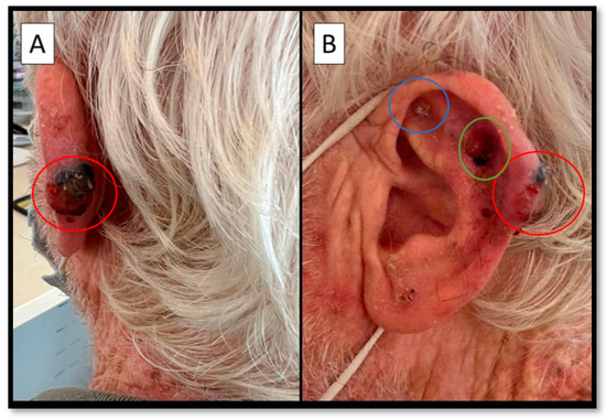 Diagnostics 12 02713 g001