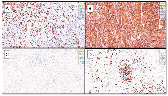 Diagnostics 12 02713 g004