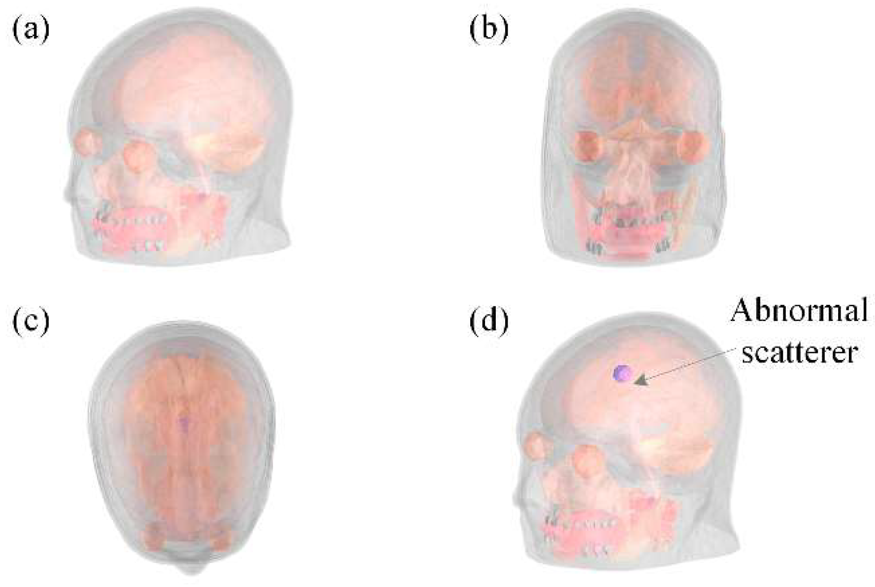 Diagnostics 12 02786 g005 Diagnostics 12 02786 g005