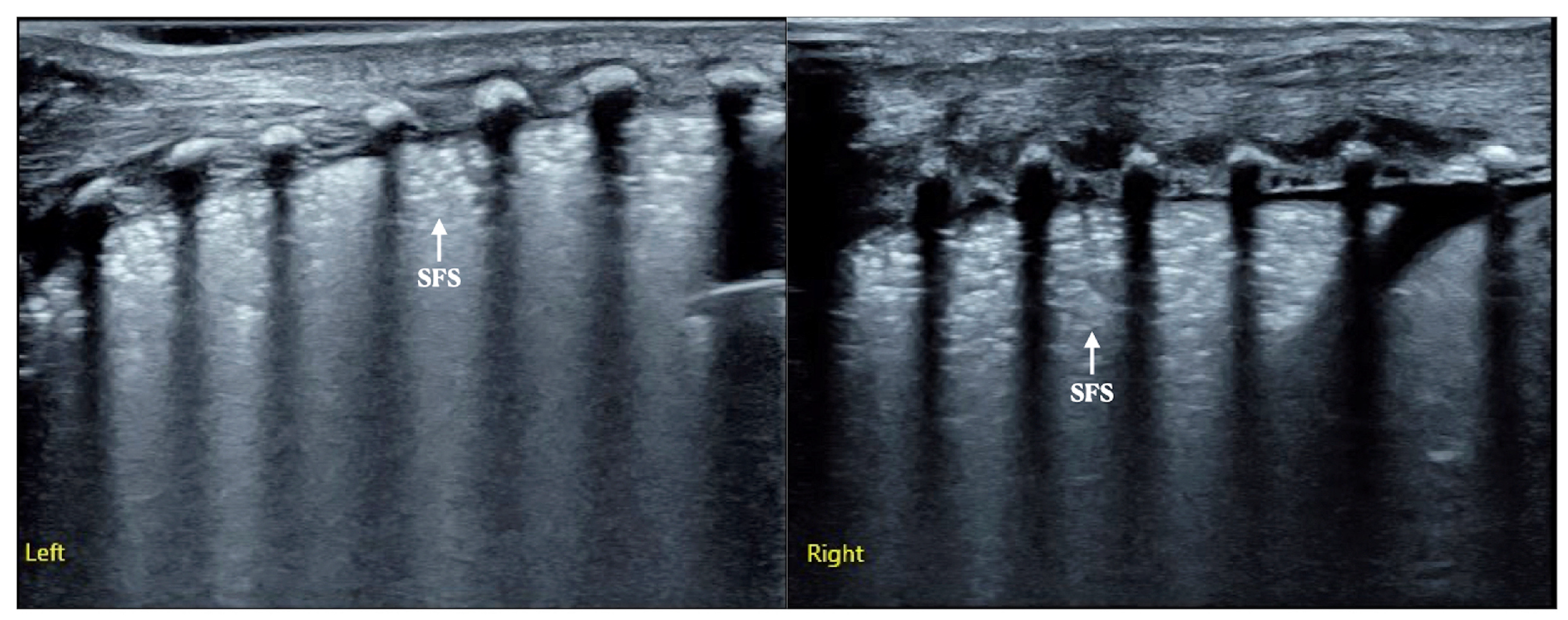 Diagnostics 12 02790 g003 Diagnostics 12 02790 g003