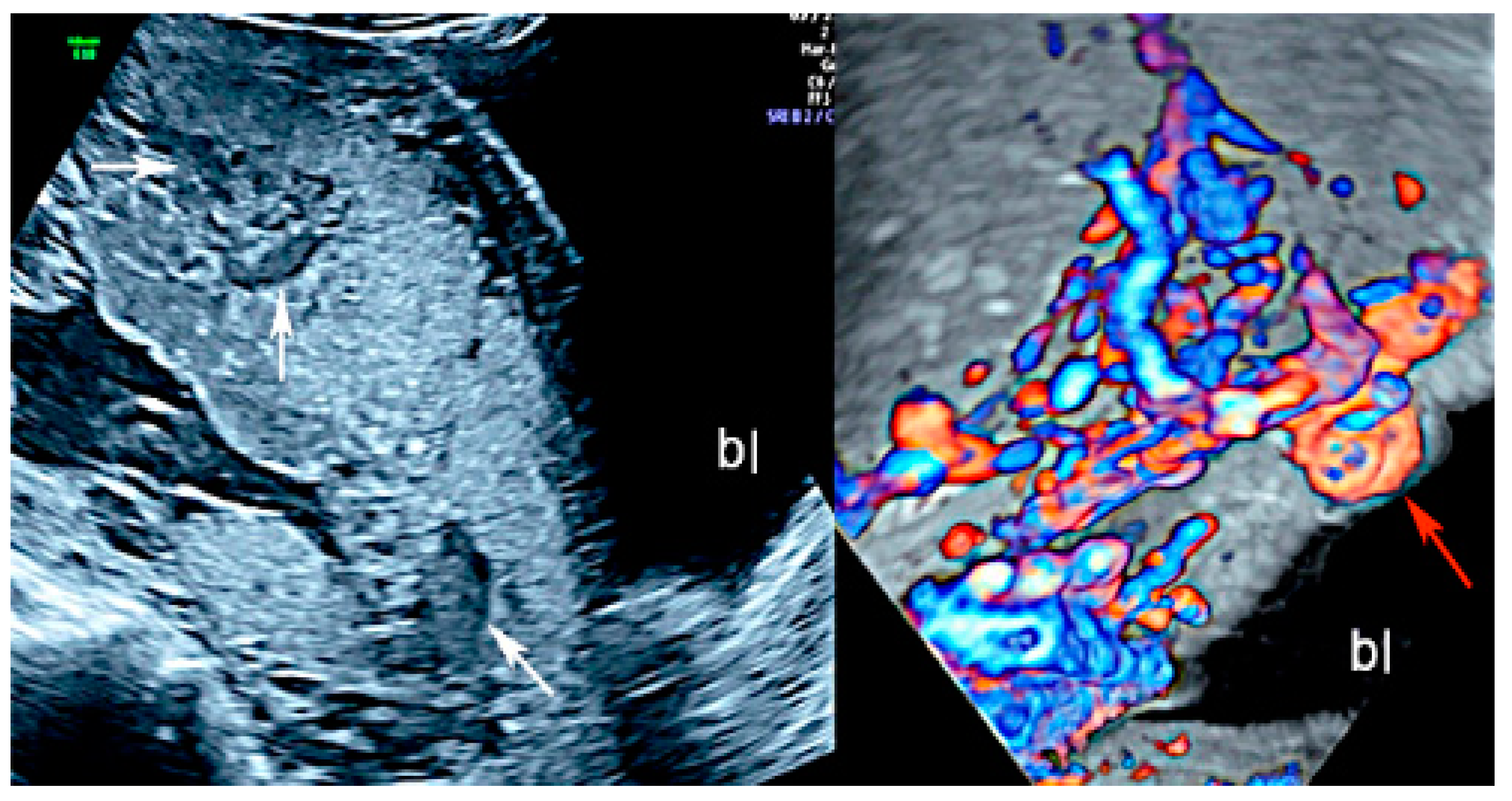 Diagnostics 12 02810 g001 Diagnostics 12 02810 g001