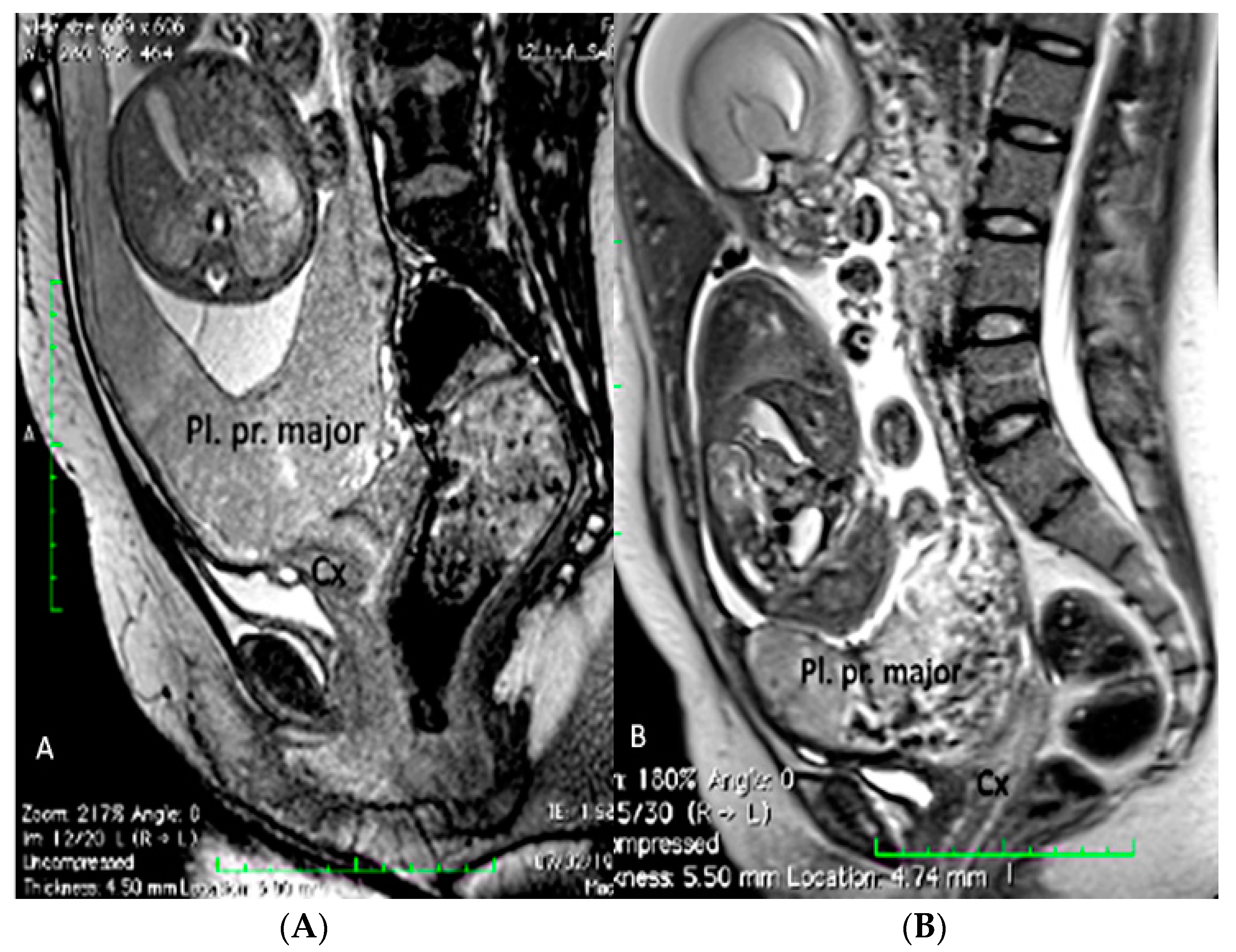 Diagnostics 12 02810 g004 Diagnostics 12 02810 g004