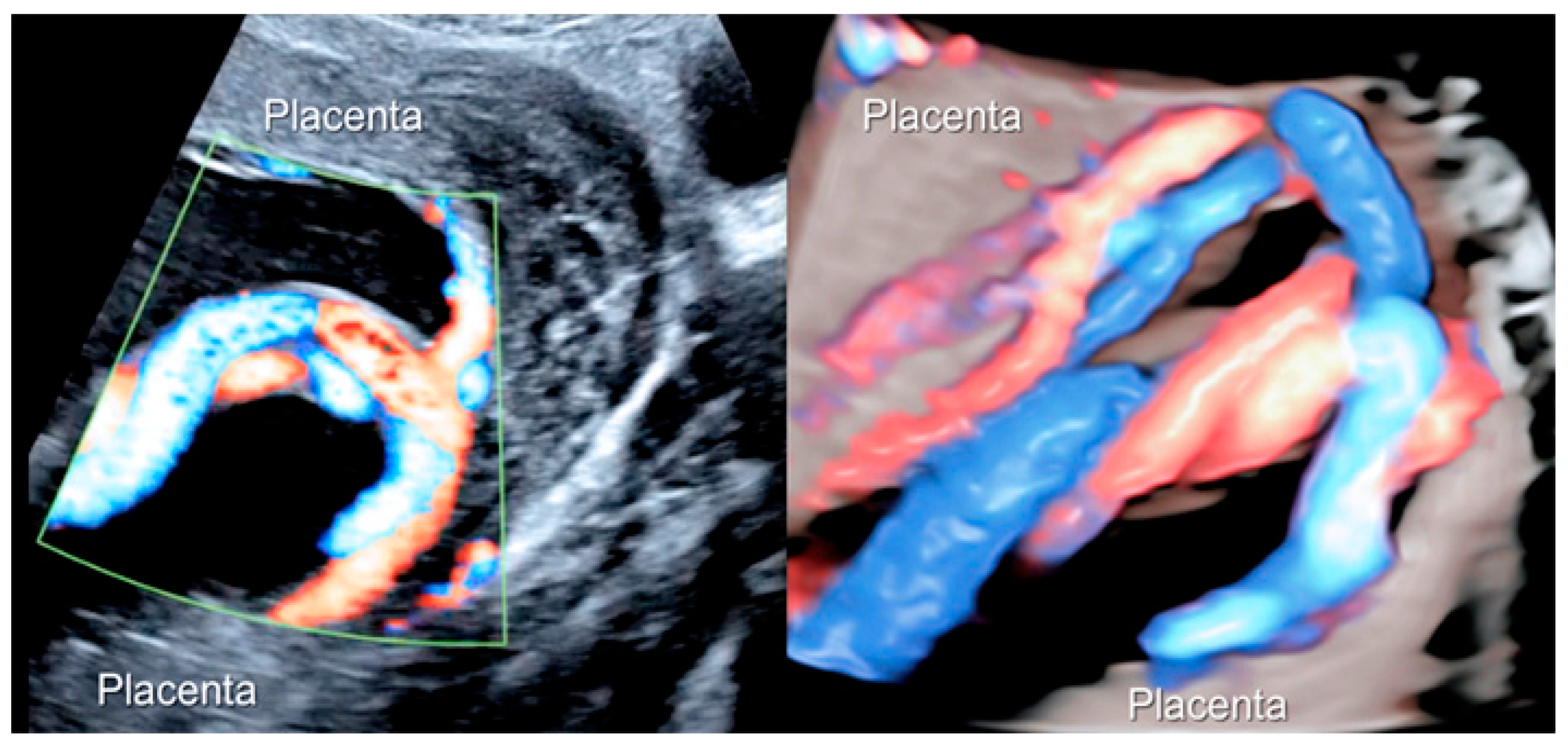 Diagnostics 12 02810 g005 Diagnostics 12 02810 g005