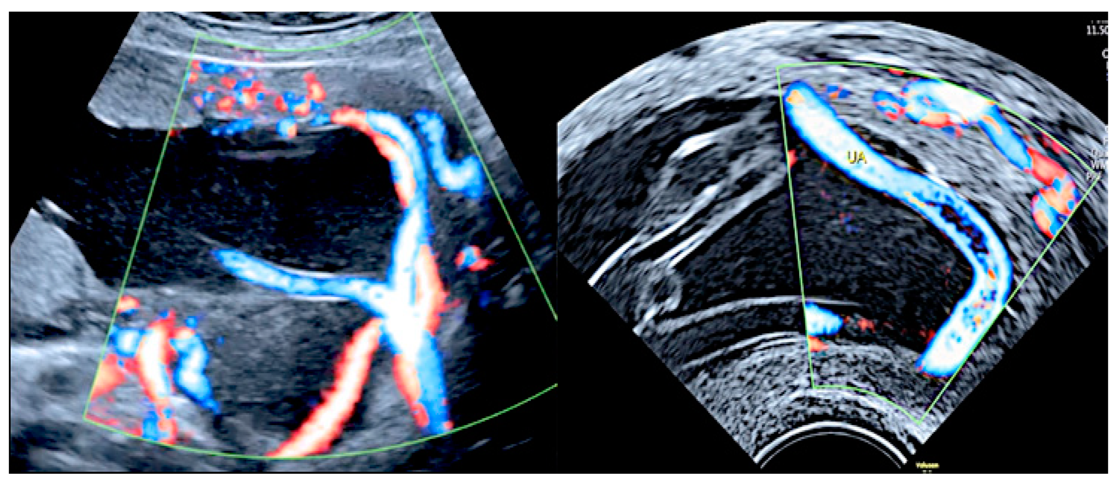 Diagnostics 12 02810 g006 Diagnostics 12 02810 g006