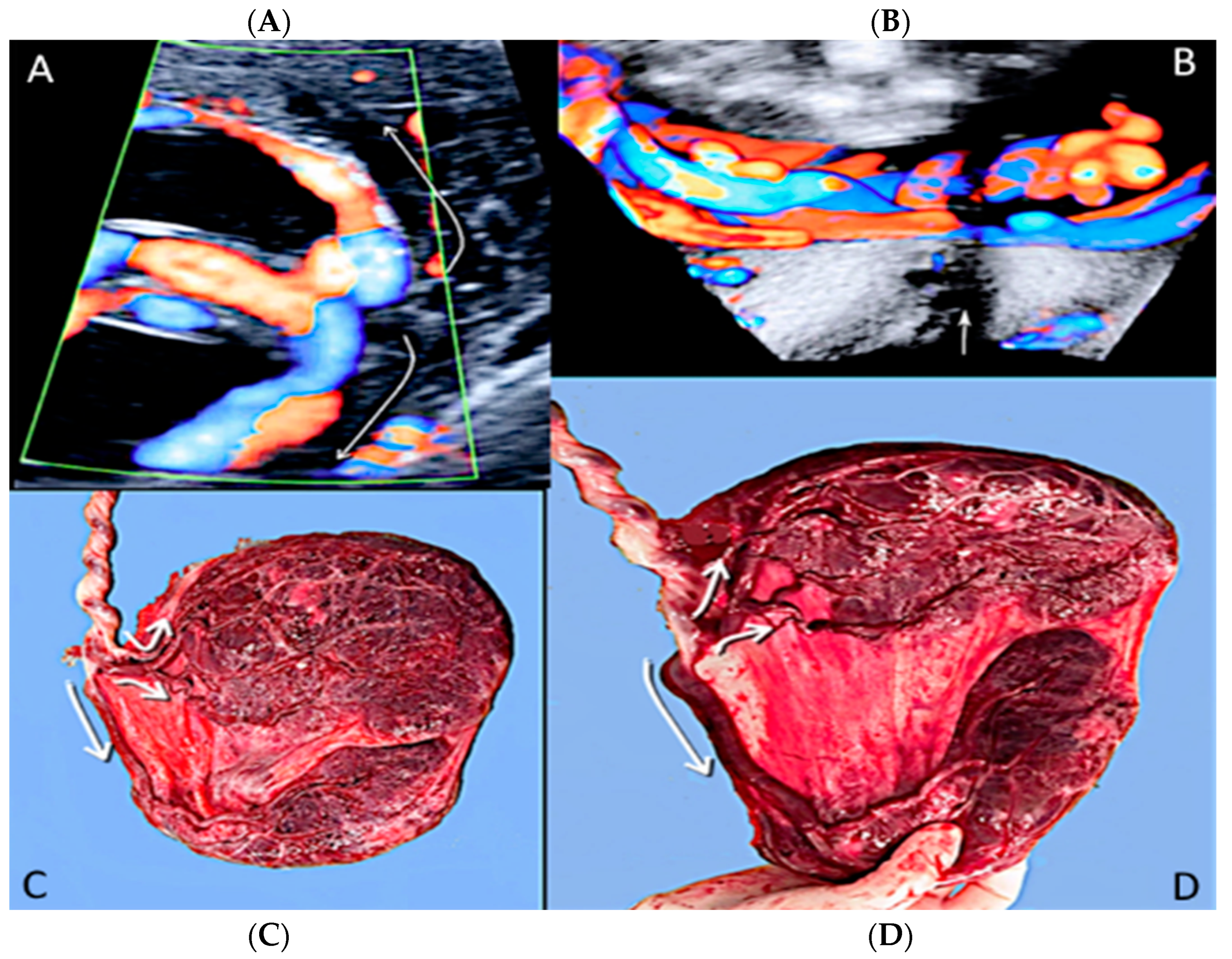 Diagnostics 12 02810 g007 Diagnostics 12 02810 g007