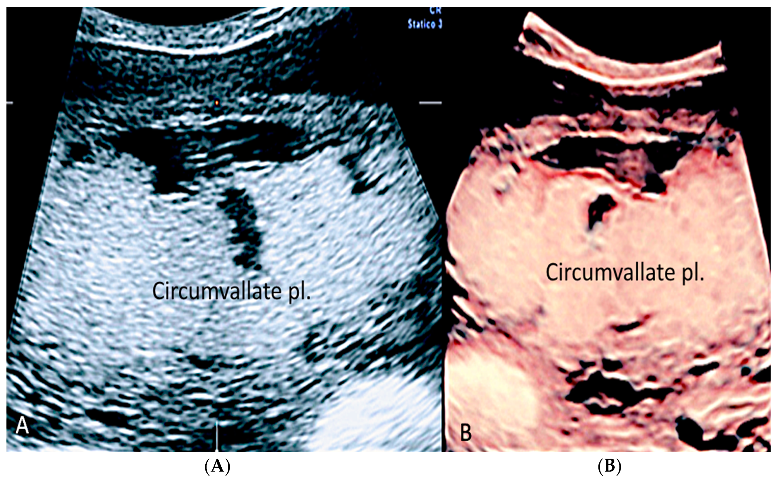 Diagnostics 12 02810 g009 Diagnostics 12 02810 g009