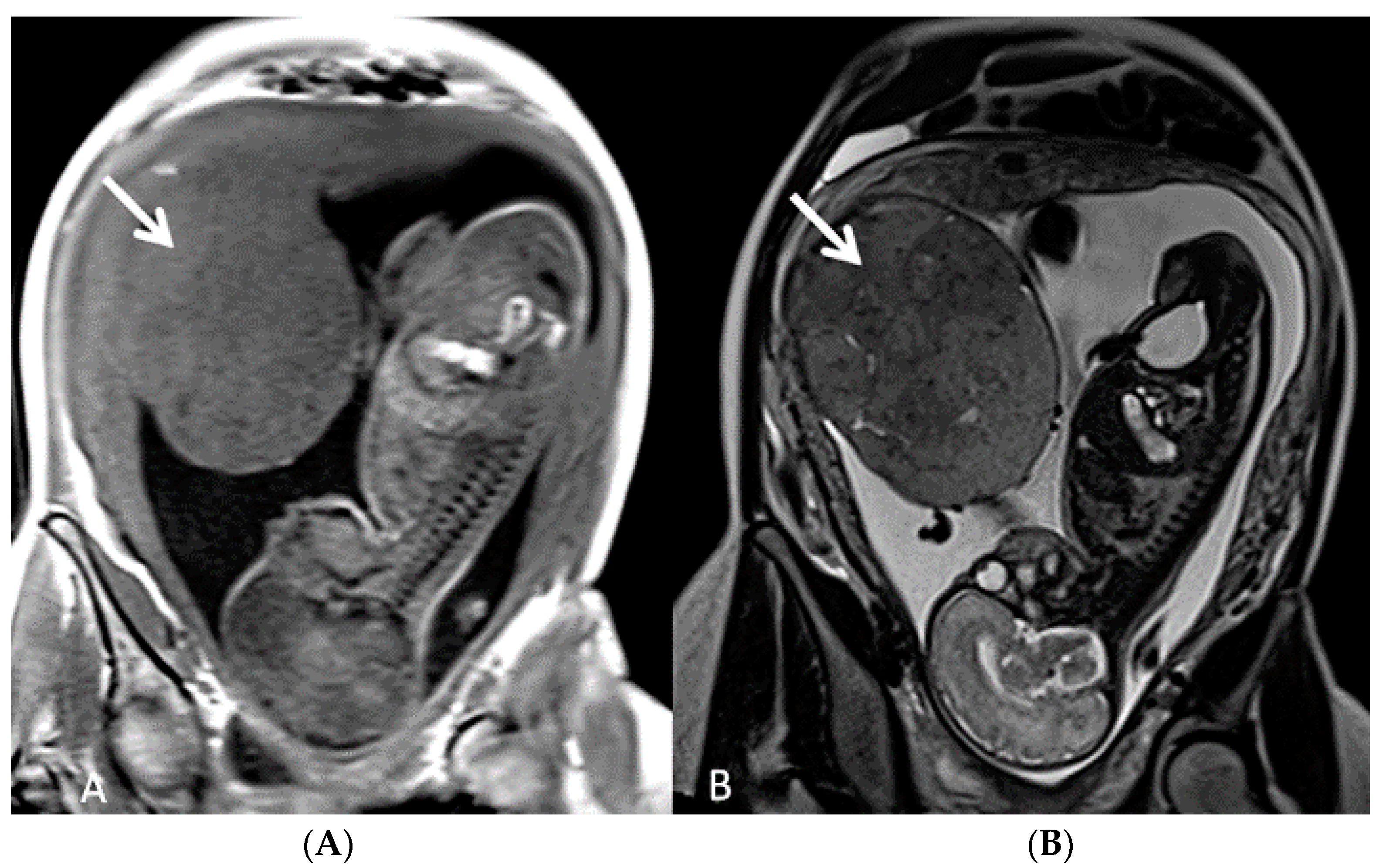 Diagnostics 12 02810 g010 Diagnostics 12 02810 g010