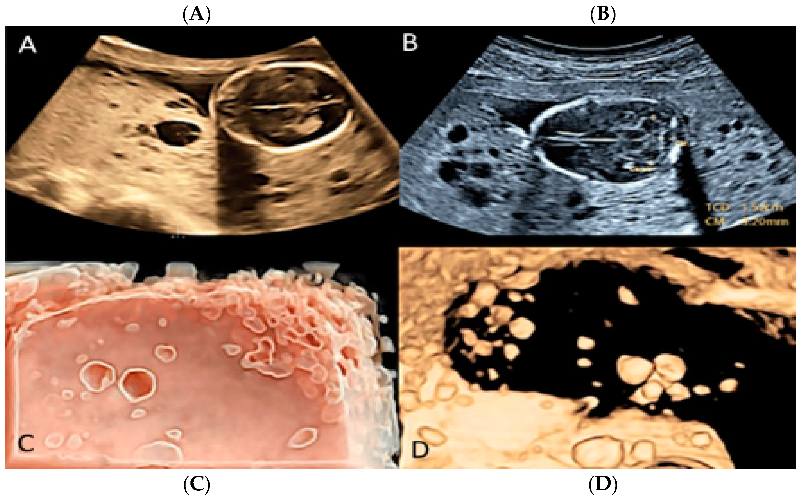 Diagnostics 12 02810 g011 Diagnostics 12 02810 g011