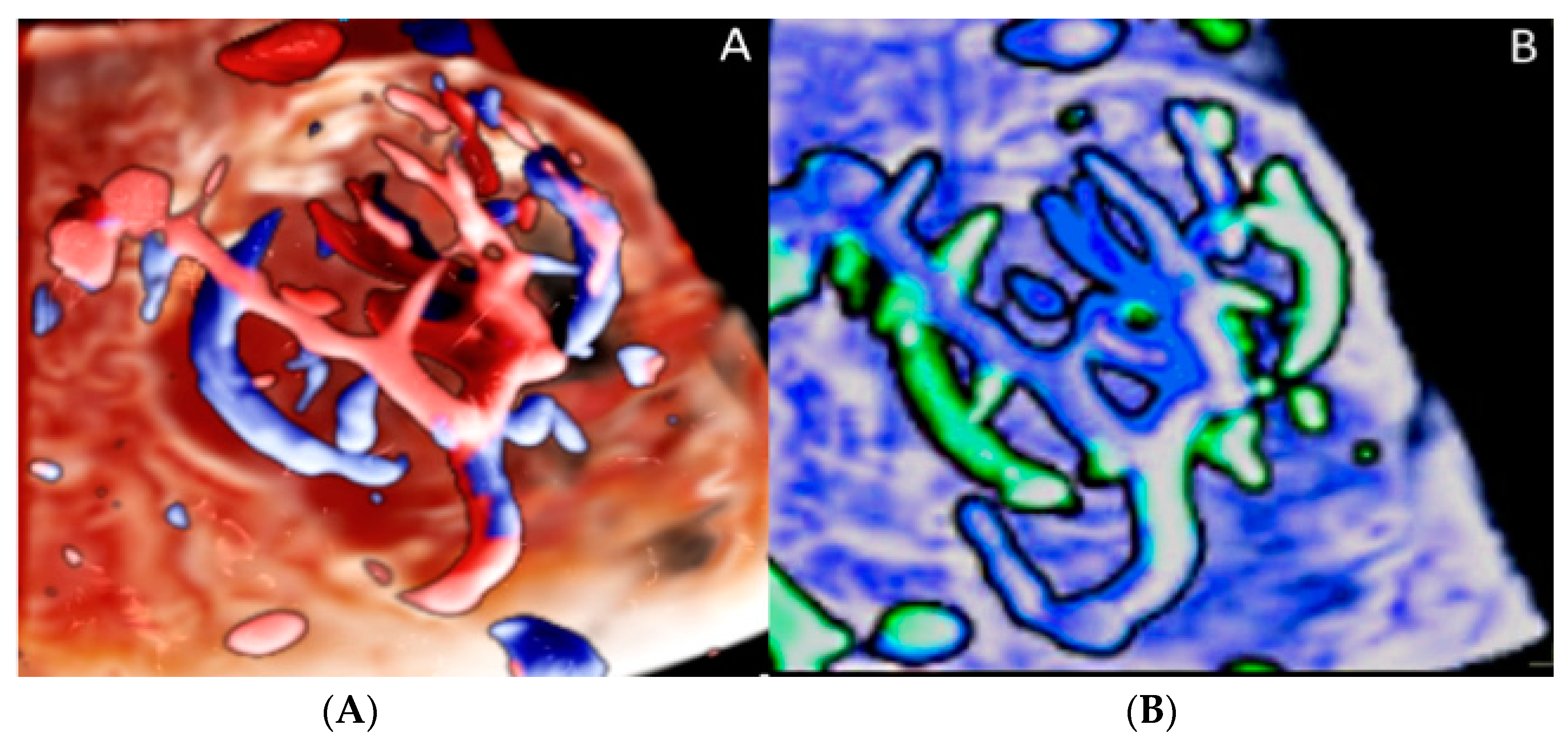 Diagnostics 12 02810 g012 Diagnostics 12 02810 g012