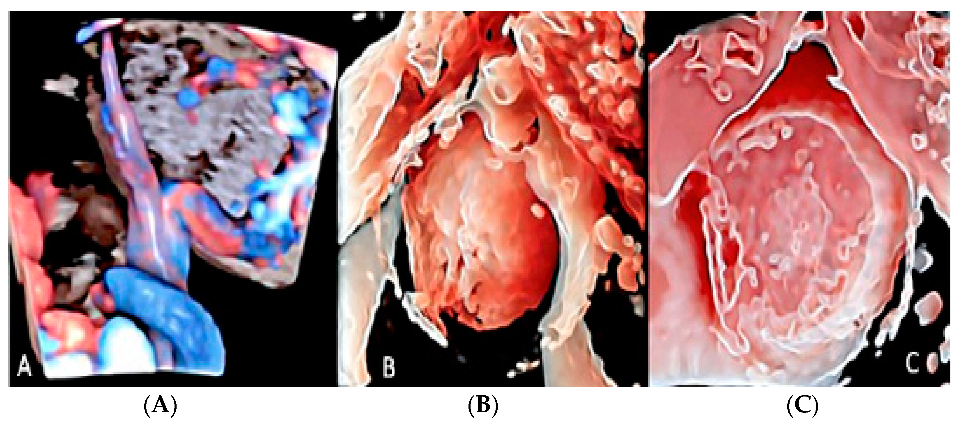 Diagnostics 12 02810 g013 Diagnostics 12 02810 g013