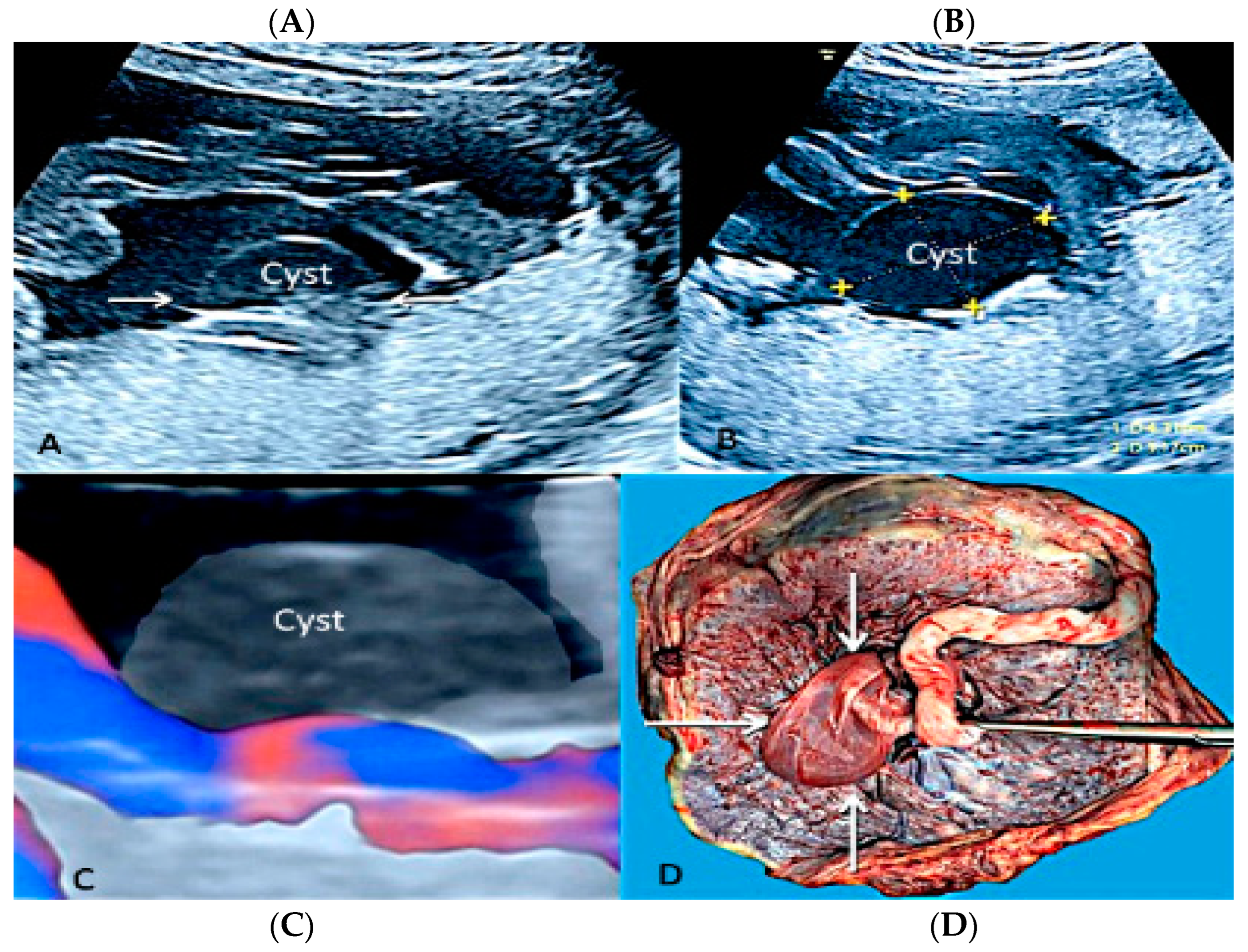 Diagnostics 12 02810 g014 Diagnostics 12 02810 g014