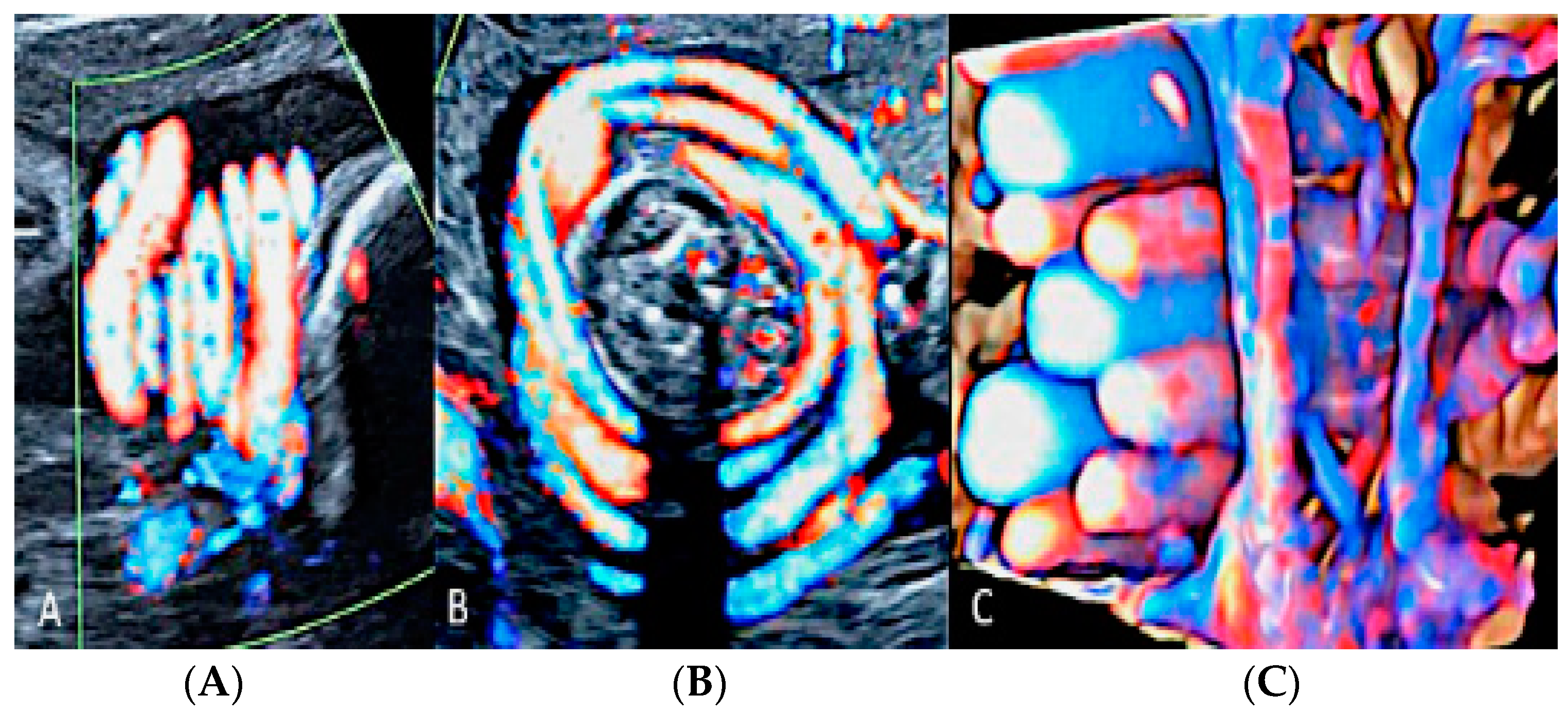 Diagnostics 12 02810 g015 Diagnostics 12 02810 g015
