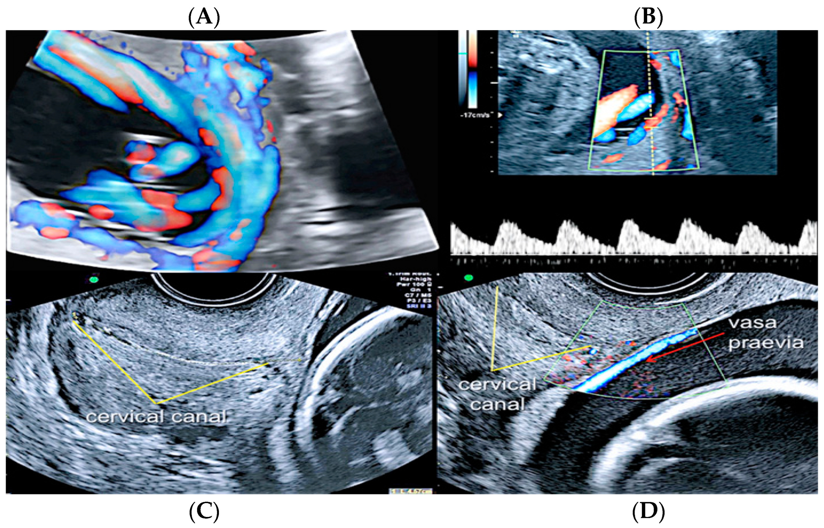 Diagnostics 12 02810 g016 Diagnostics 12 02810 g016