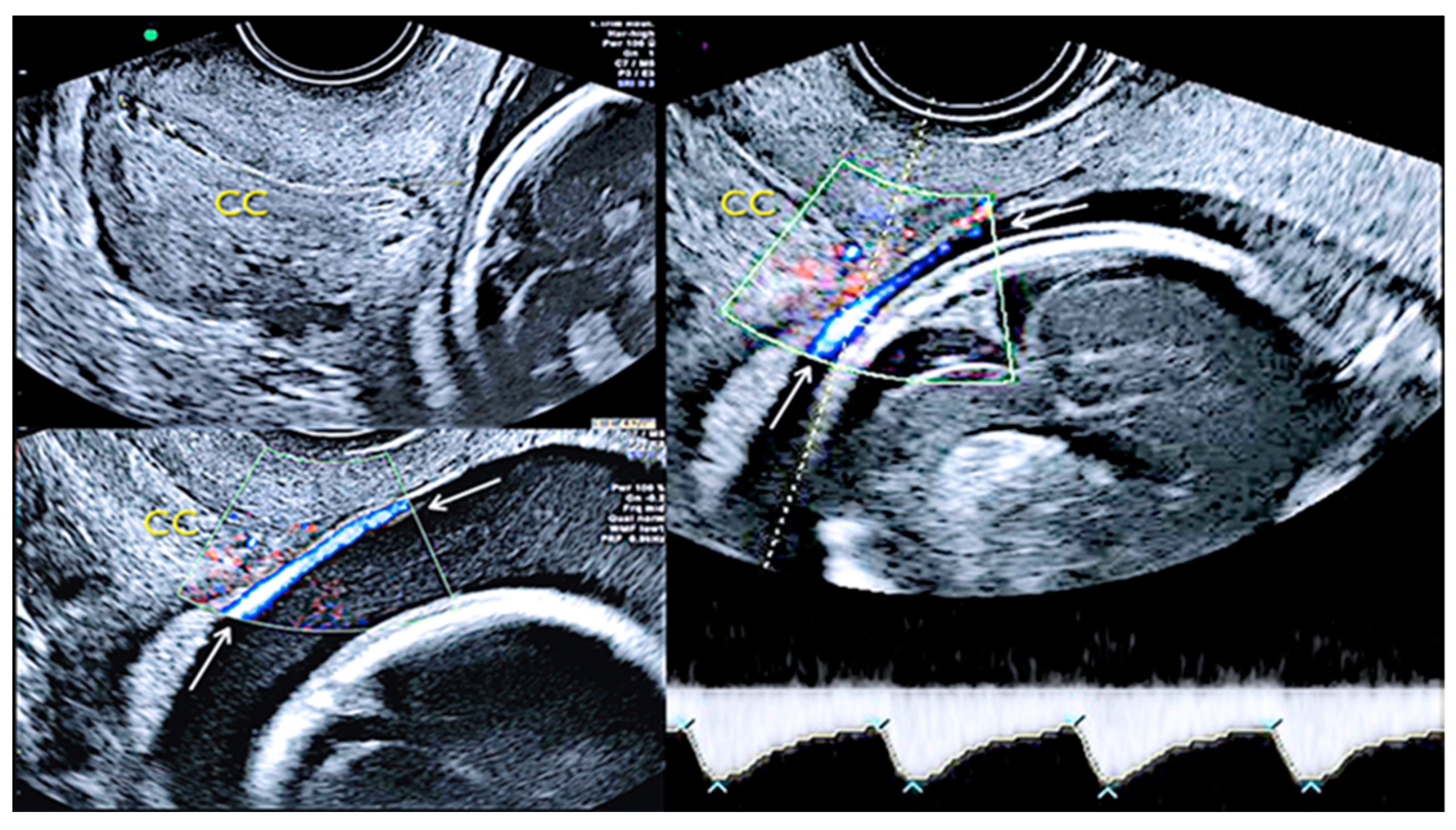 Diagnostics 12 02810 g017 Diagnostics 12 02810 g017