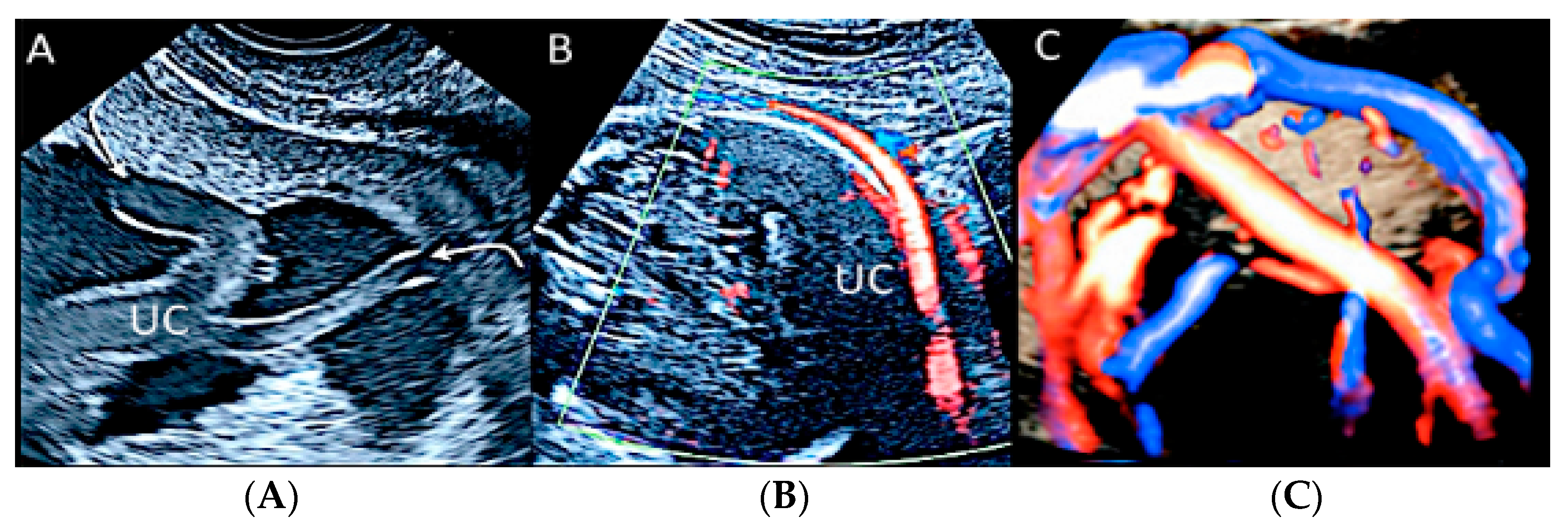 Diagnostics 12 02810 g022 Diagnostics 12 02810 g022