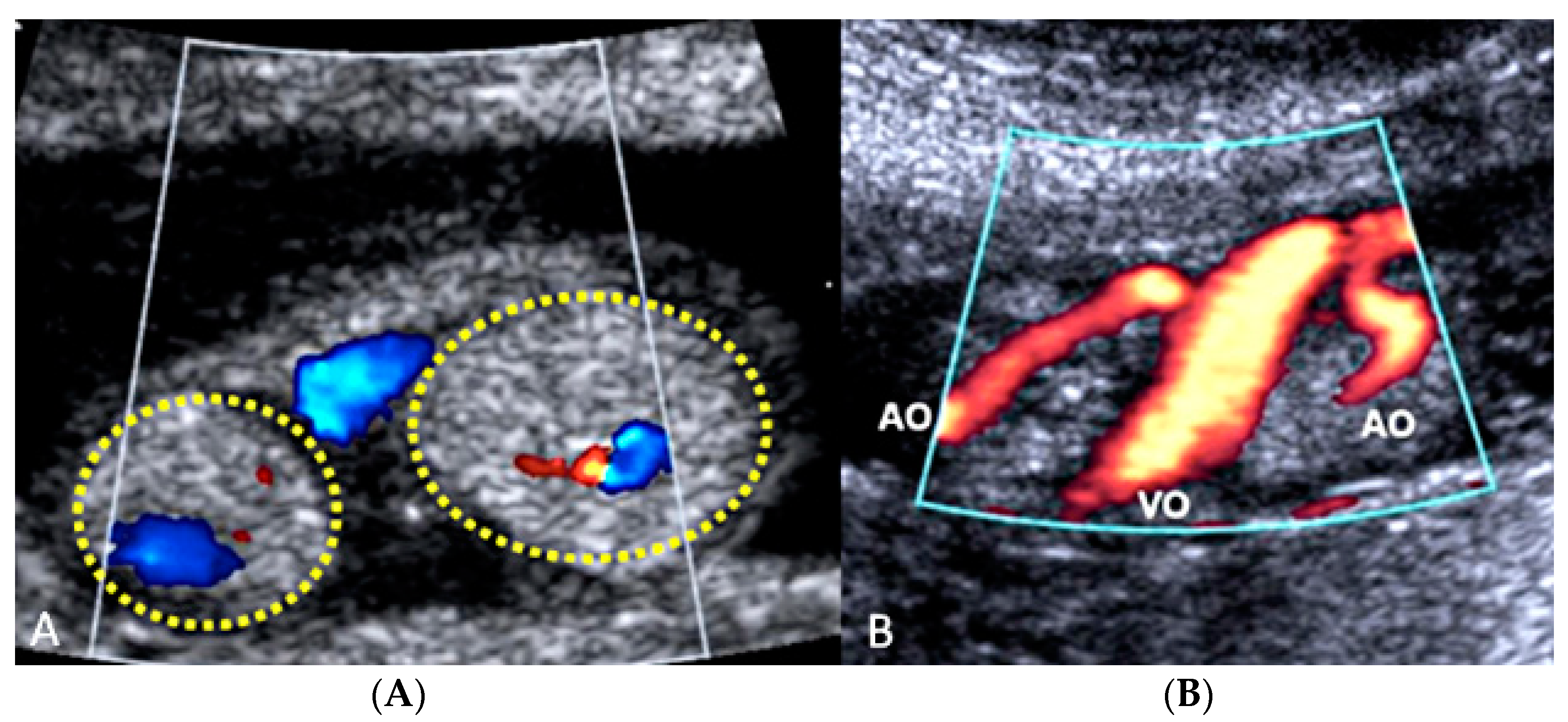 Diagnostics 12 02810 g026 Diagnostics 12 02810 g026