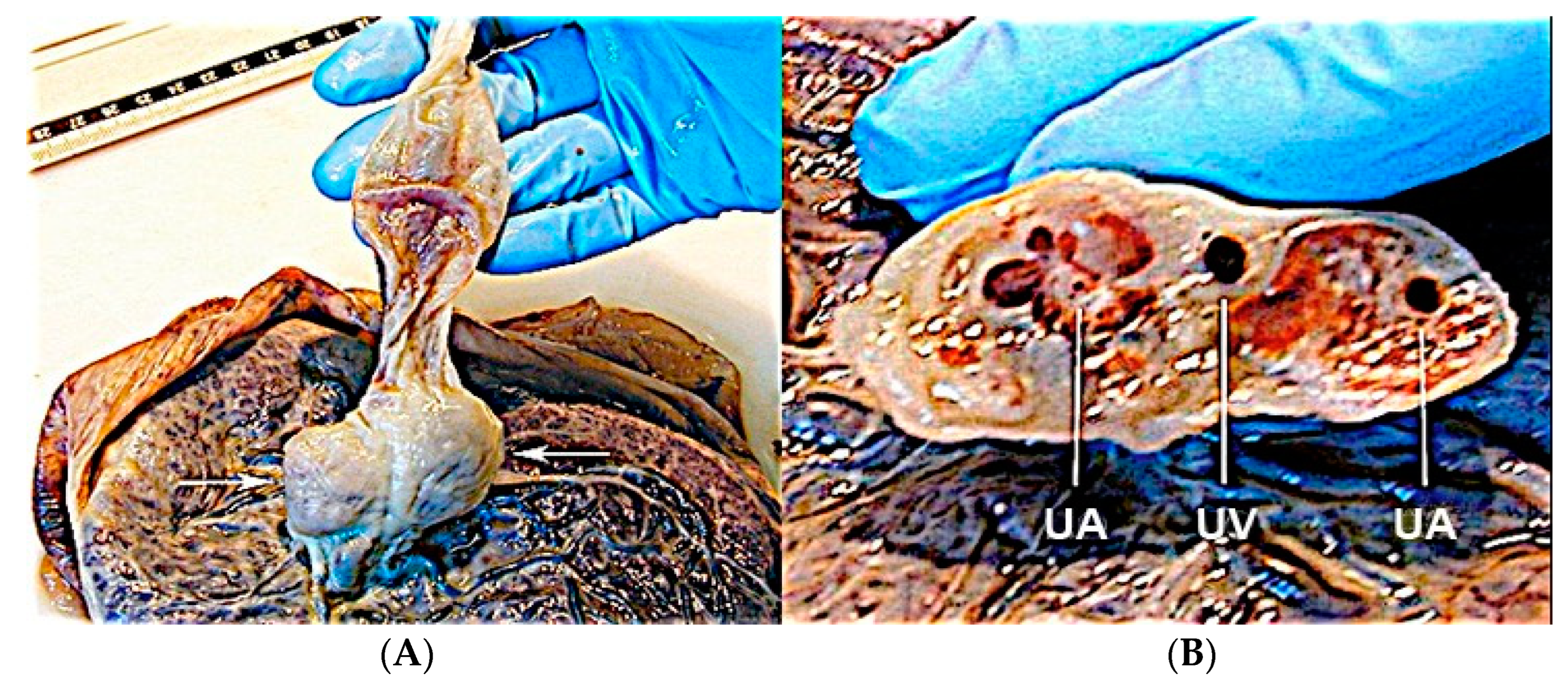 Diagnostics 12 02810 g027 Diagnostics 12 02810 g027