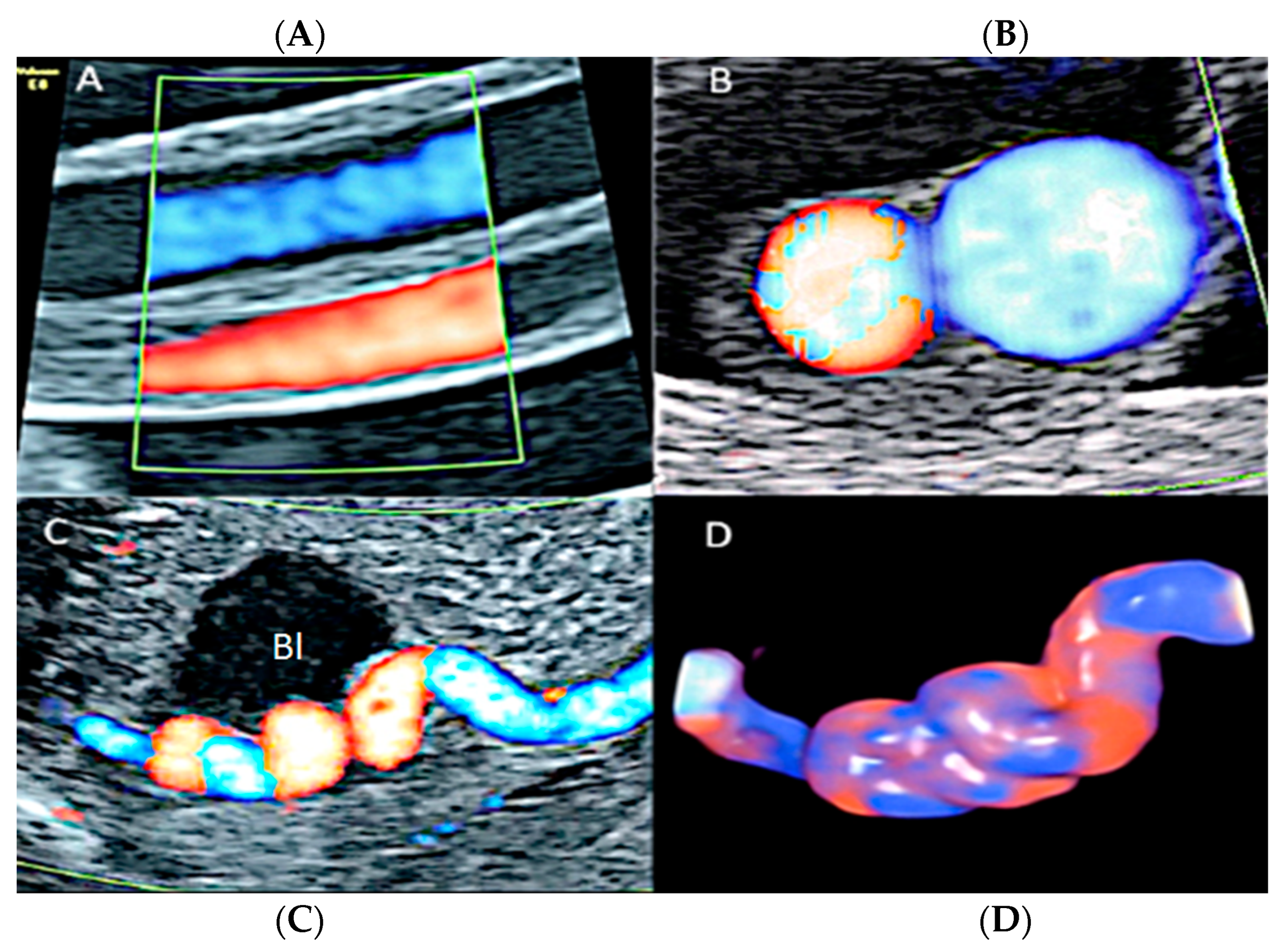 Diagnostics 12 02810 g031 Diagnostics 12 02810 g031