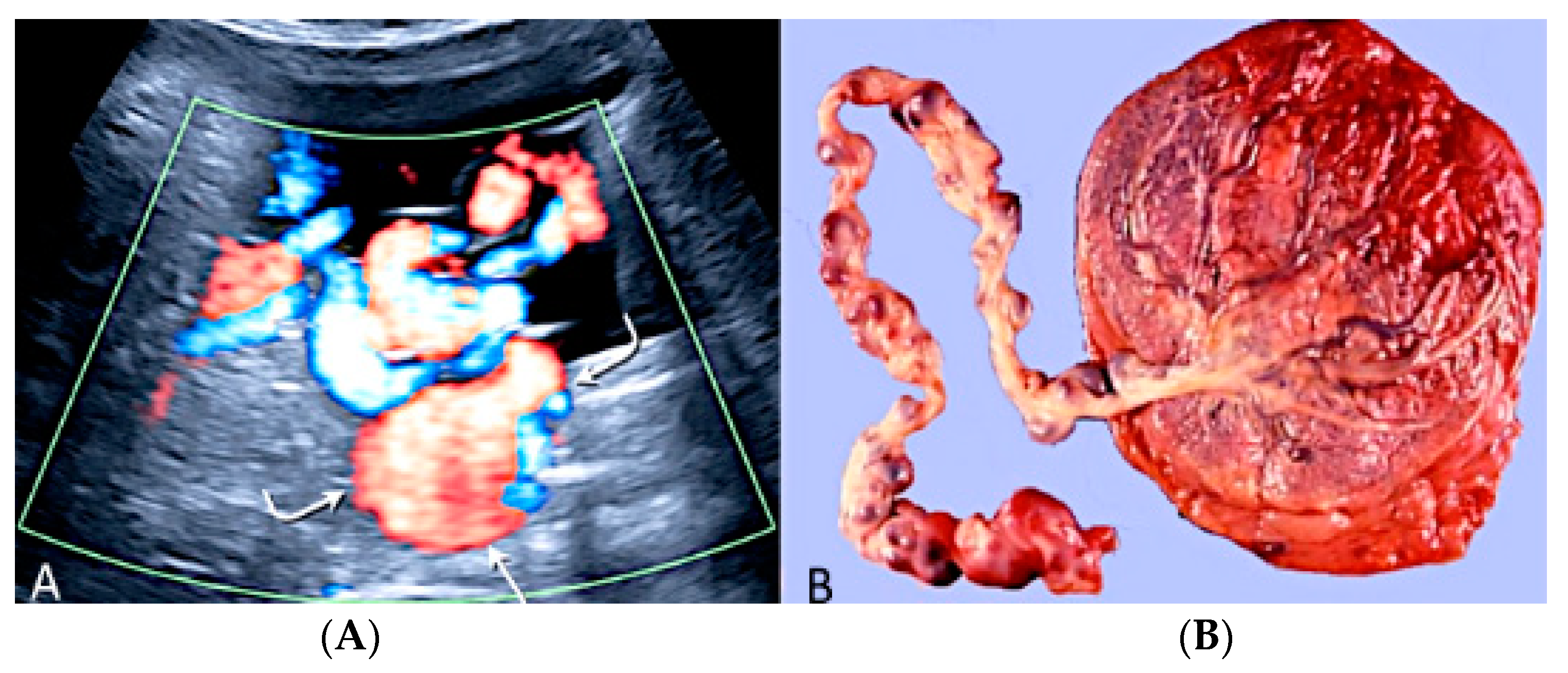 Diagnostics 12 02810 g032 Diagnostics 12 02810 g032