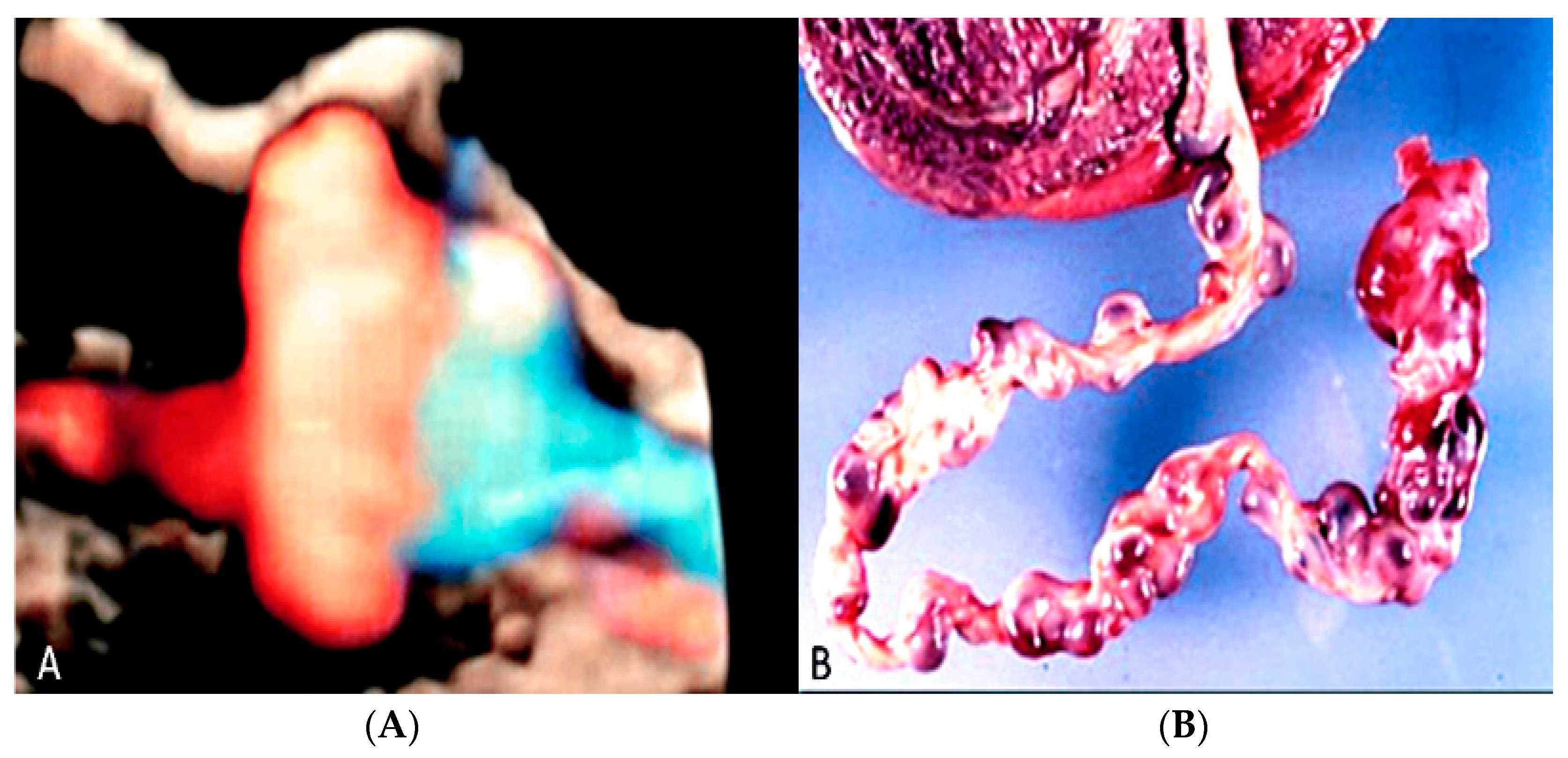 Diagnostics 12 02810 g034 Diagnostics 12 02810 g034