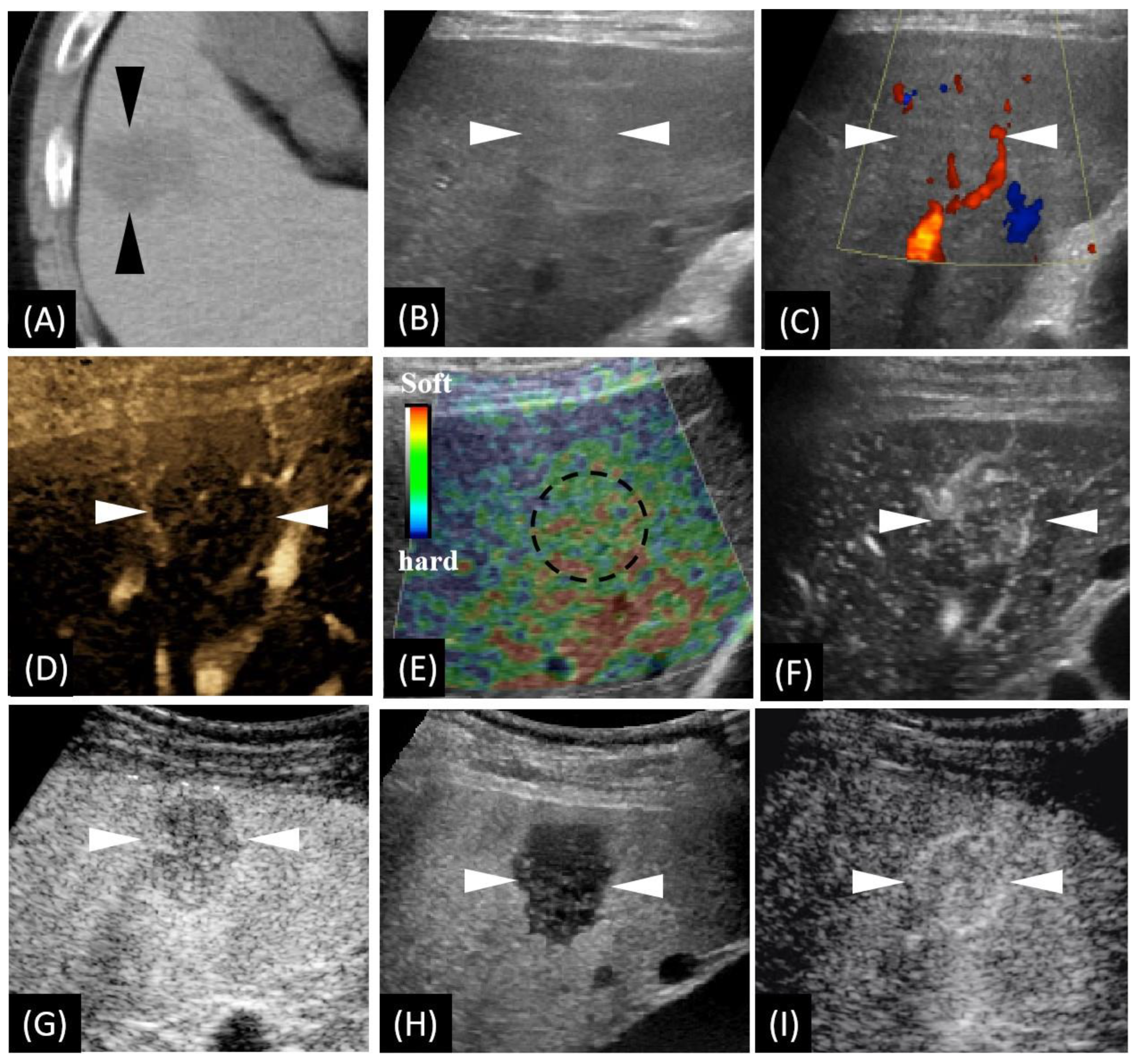 Diagnostics 12 02818 g001