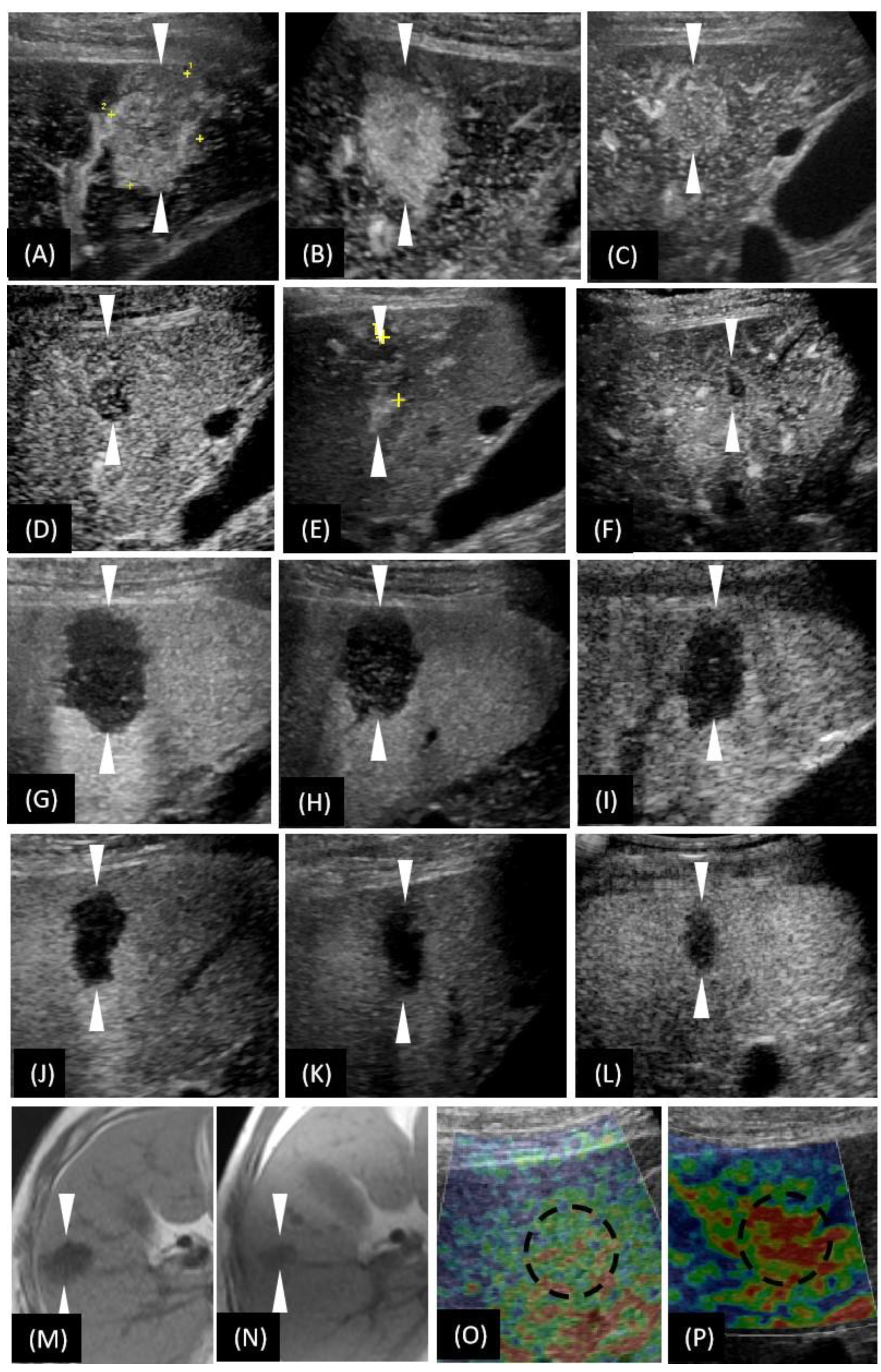 Diagnostics 12 02818 g003