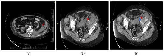 Diagnostics 12 02820 g001