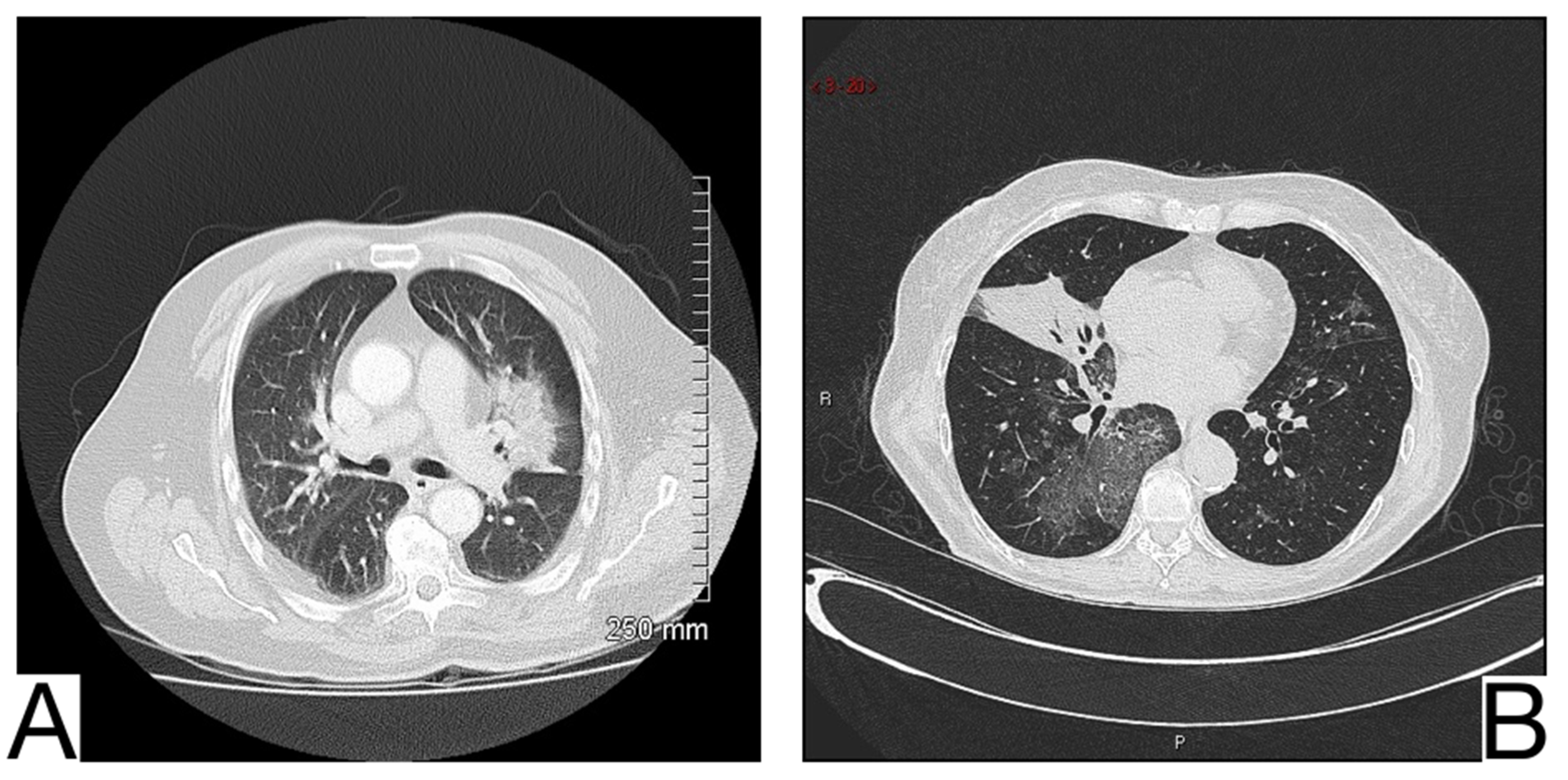 Diagnostics 12 02823 g011