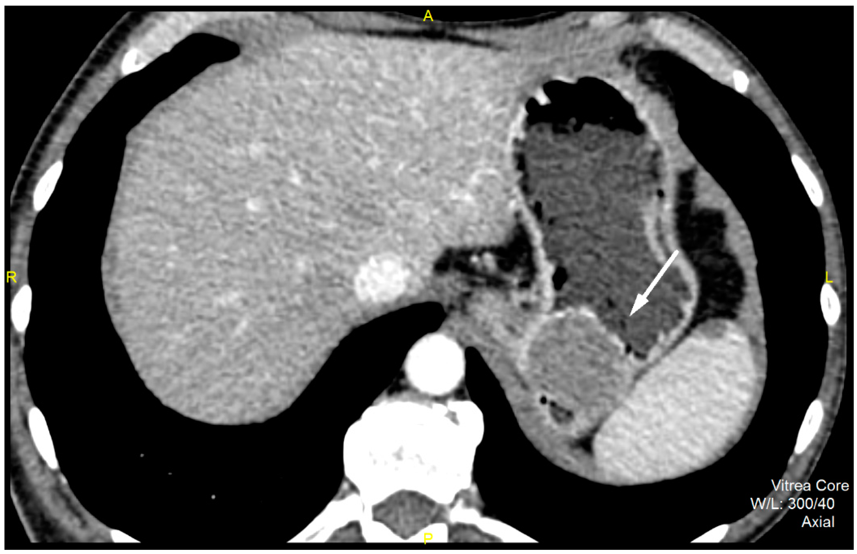 Diagnostics 12 02841 g001 Diagnostics 12 02841 g001