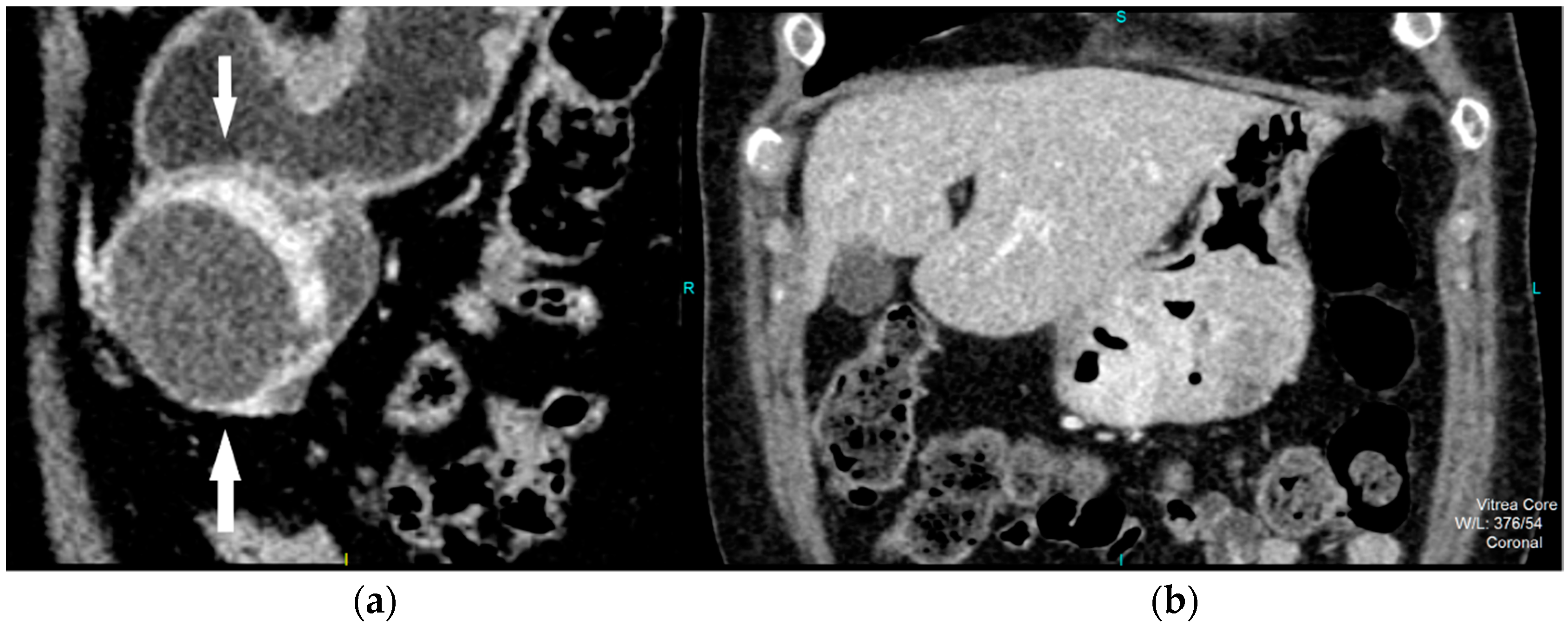 Diagnostics 12 02841 g002 Diagnostics 12 02841 g002