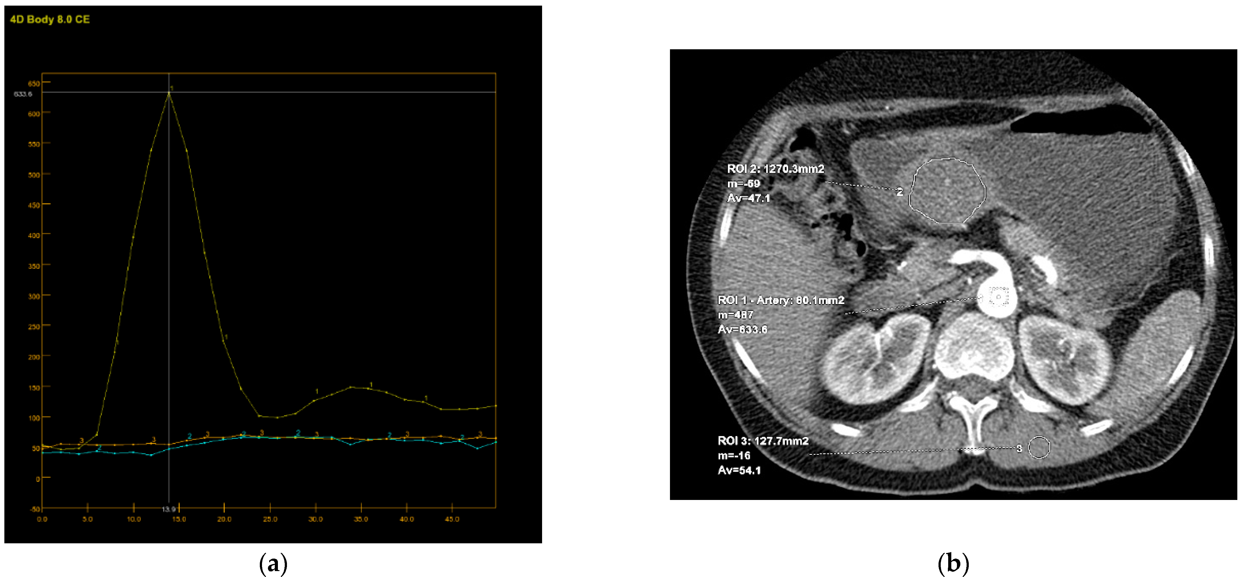Diagnostics 12 02841 g004 Diagnostics 12 02841 g004