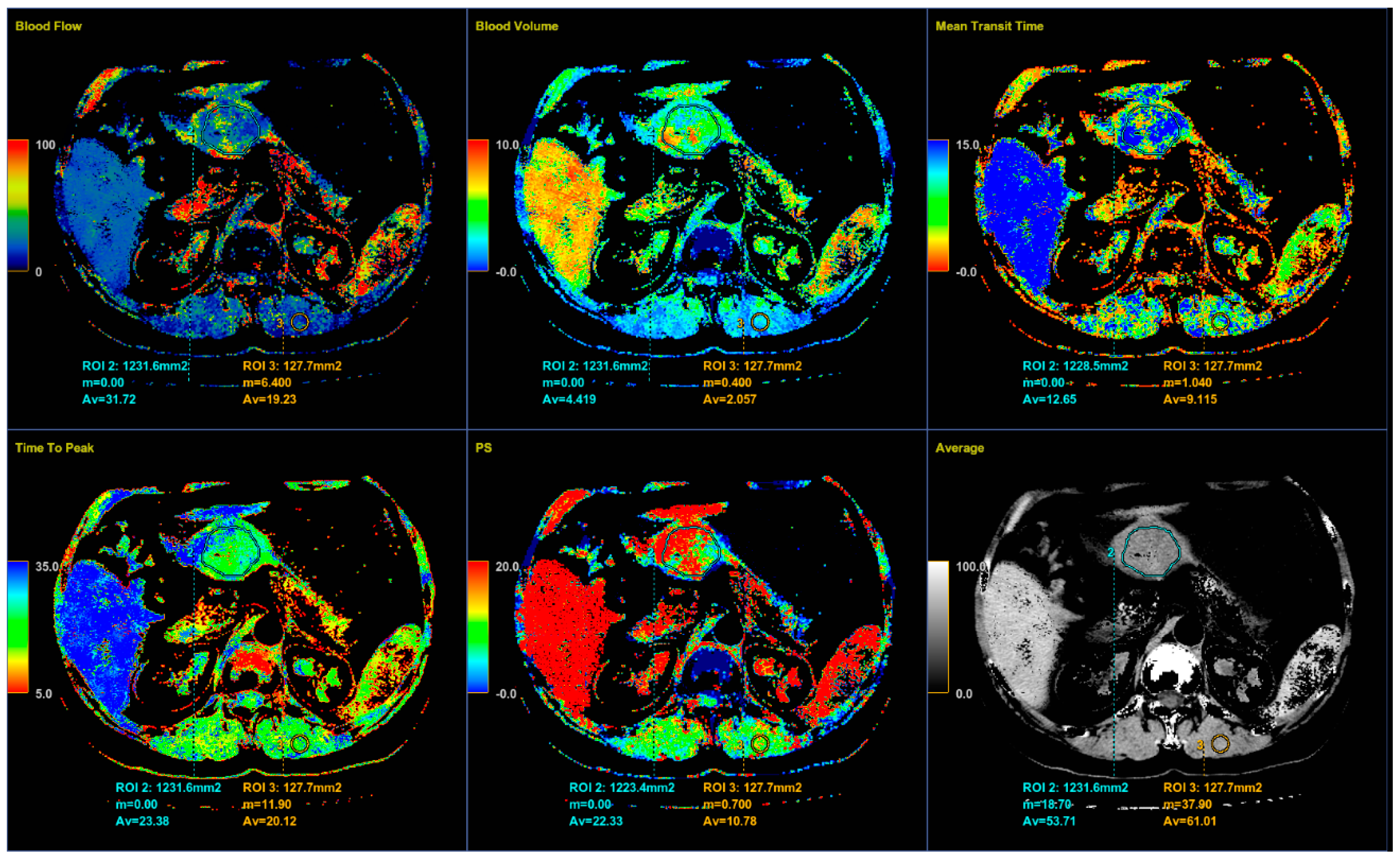 Diagnostics 12 02841 g005 Diagnostics 12 02841 g005